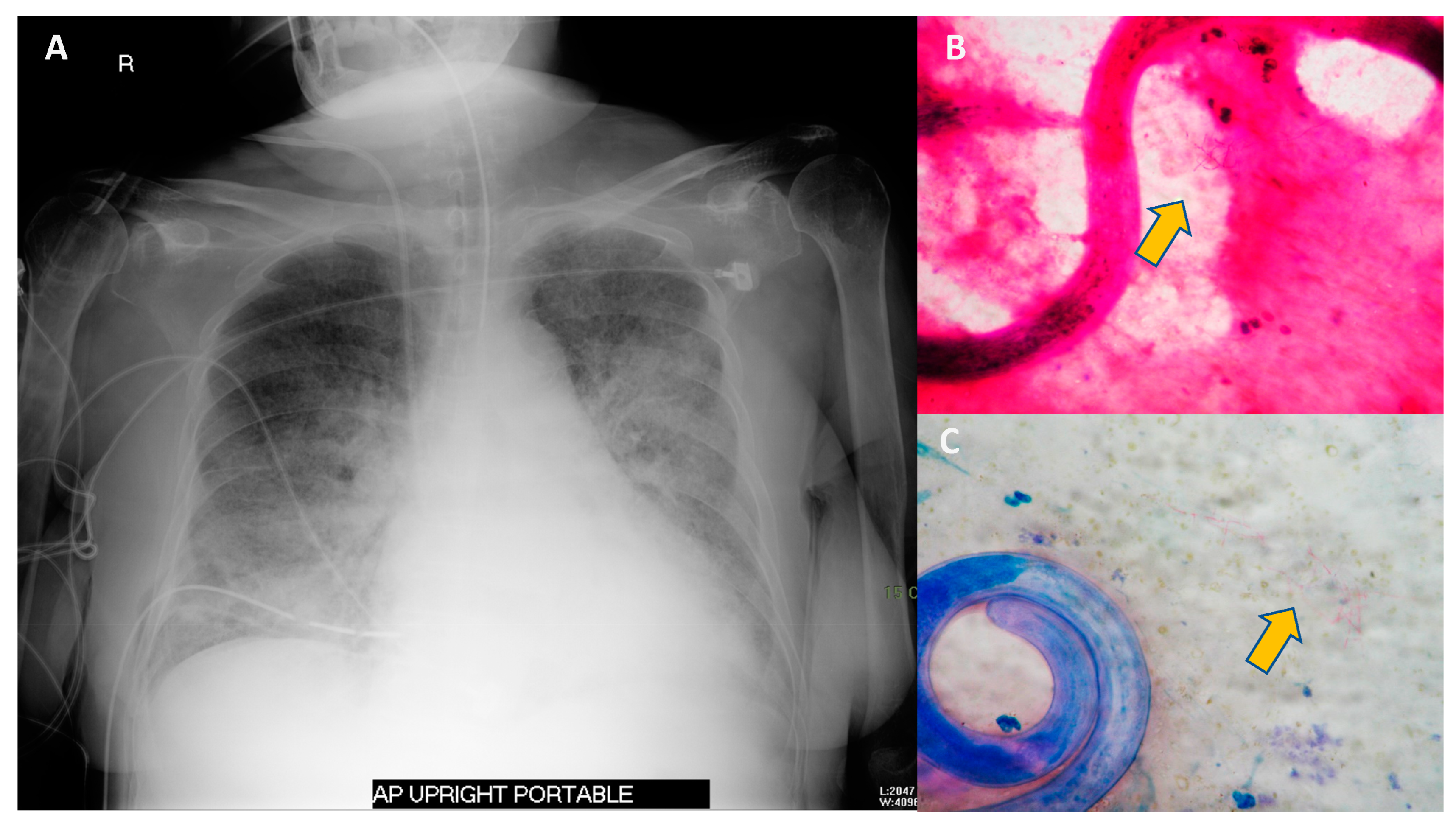 Tropicalmed 07 00310 g004
