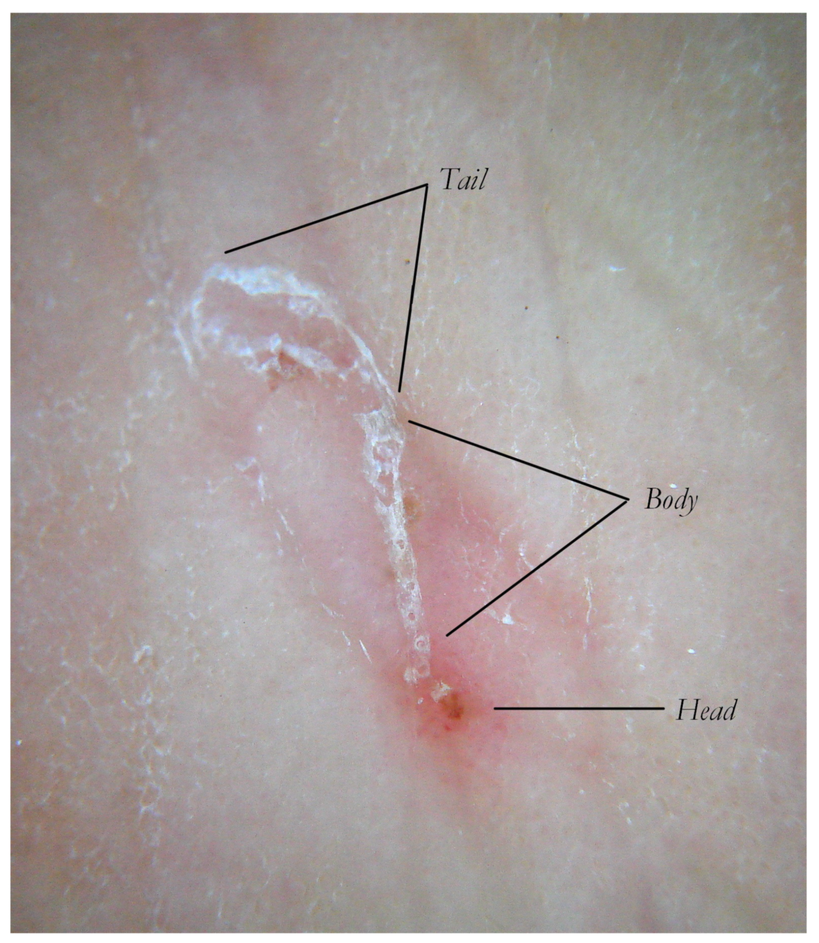 Tropicalmed 07 00422 g001