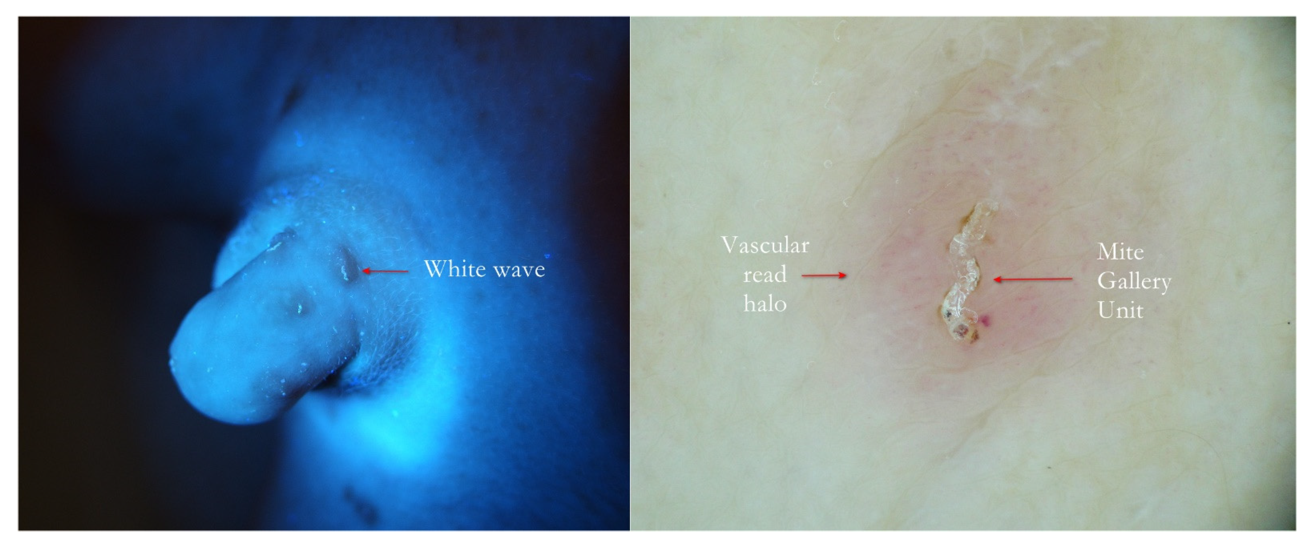 Tropicalmed 07 00422 g007