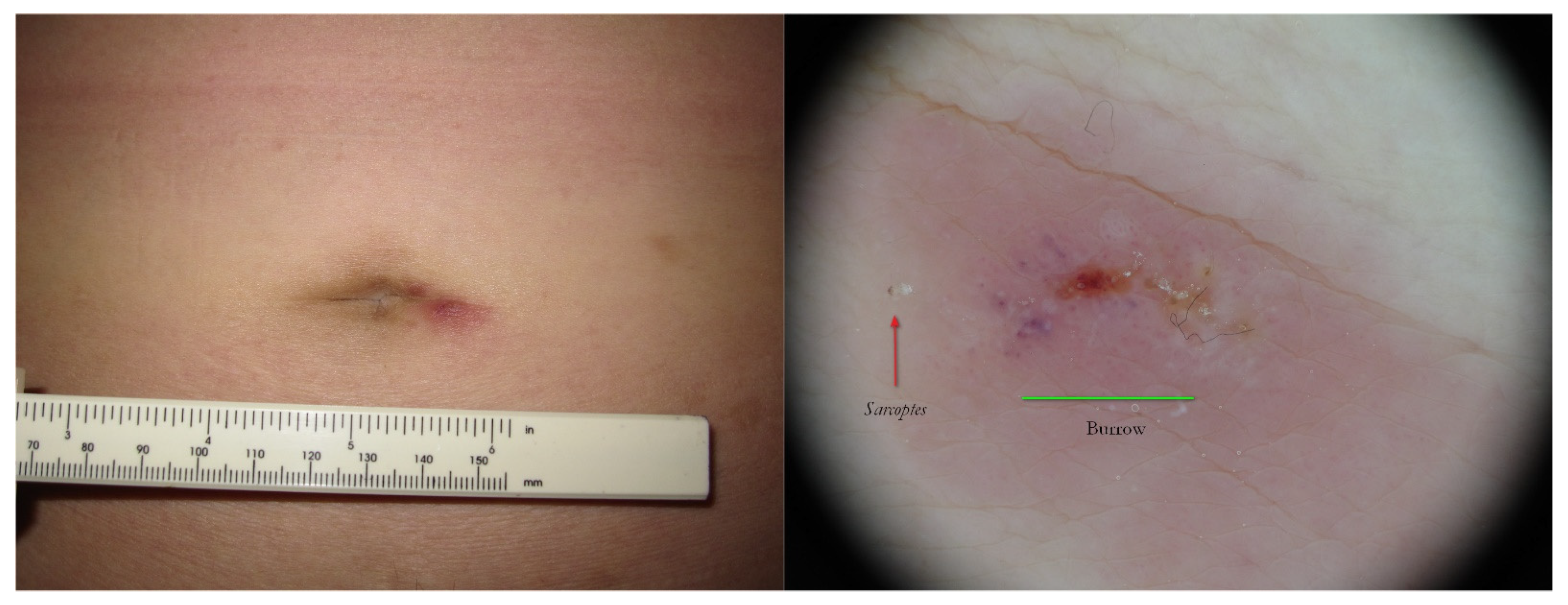 Tropicalmed 07 00422 g015