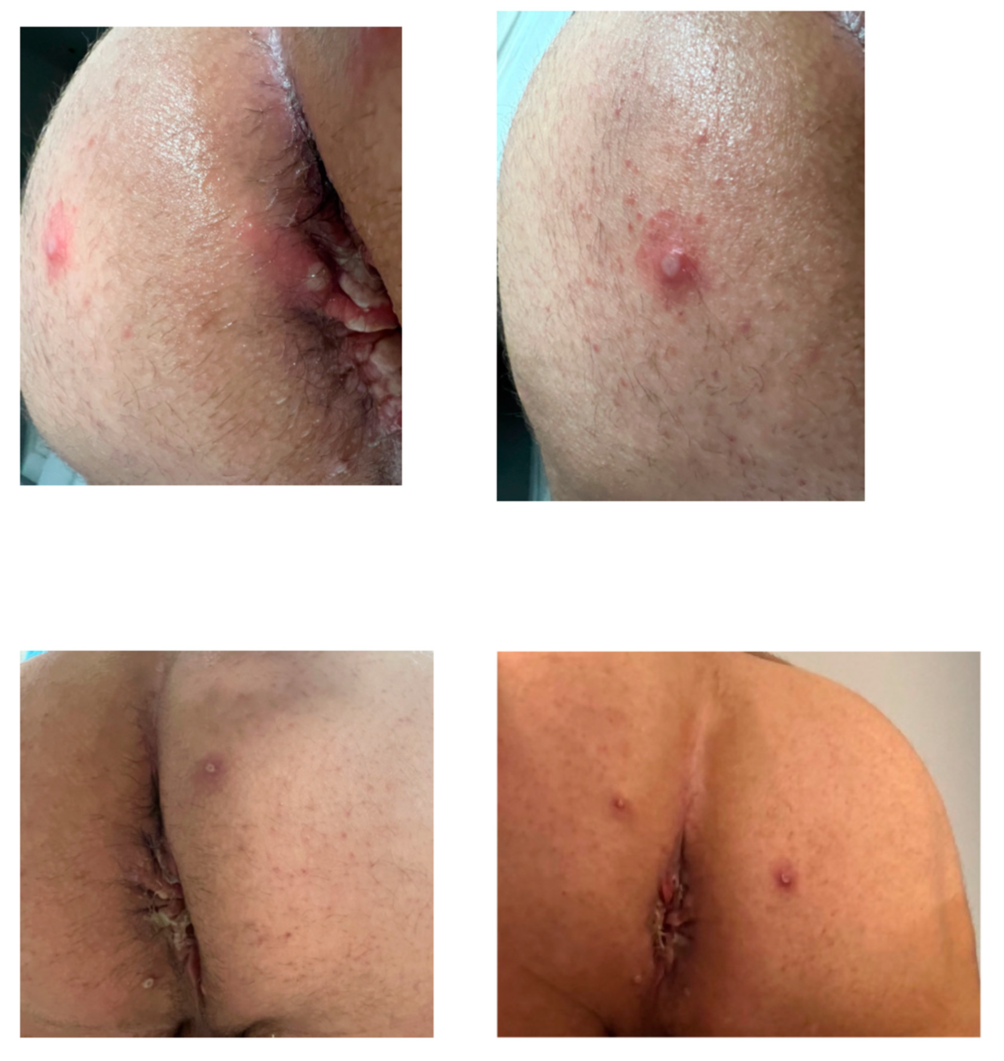 Tropicalmed 08 00015 g001