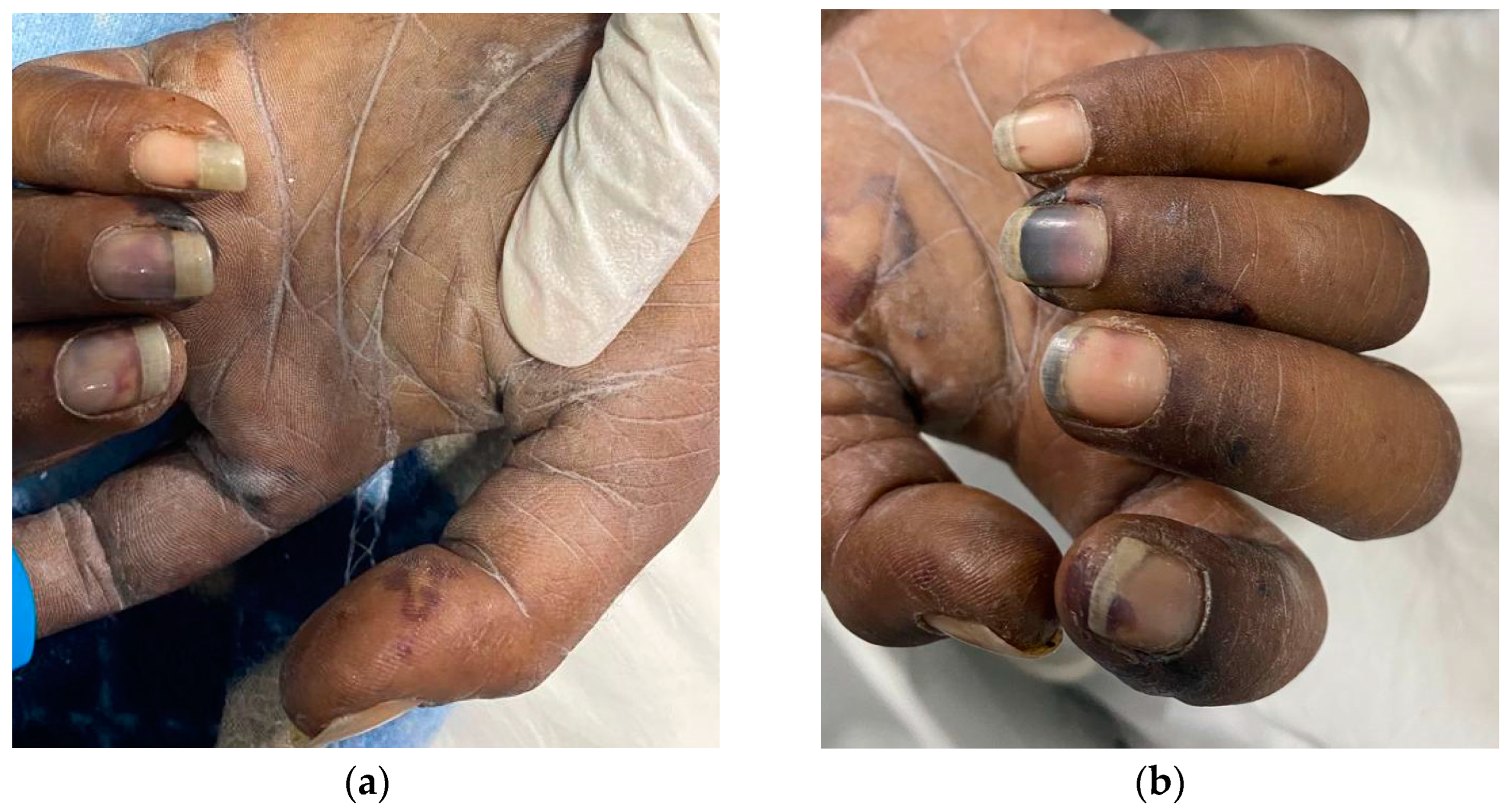 Tropicalmed 08 00053 g001 Tropicalmed 08 00053 g001