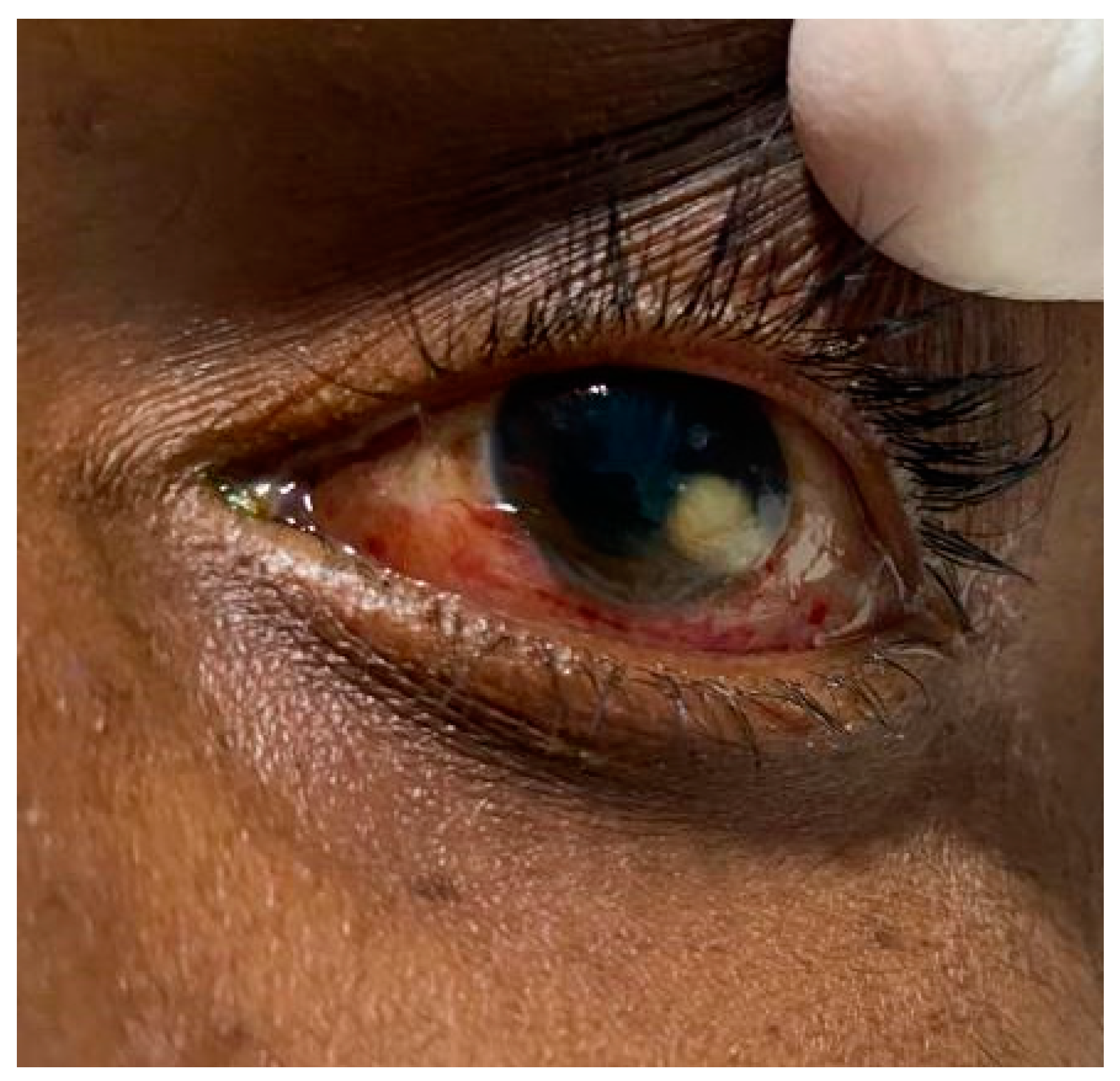 Tropicalmed 08 00053 g002 Tropicalmed 08 00053 g002