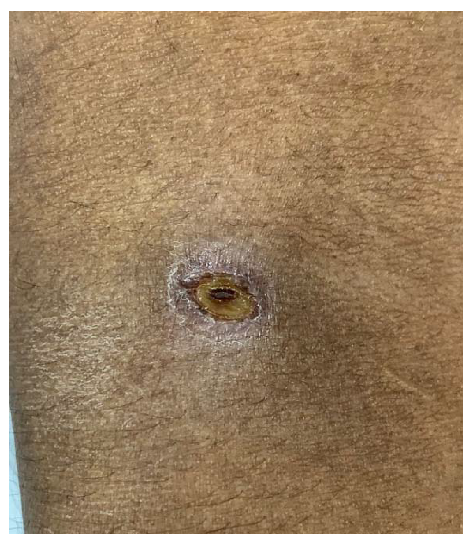 Tropicalmed 08 00082 g001 Tropicalmed 08 00082 g001