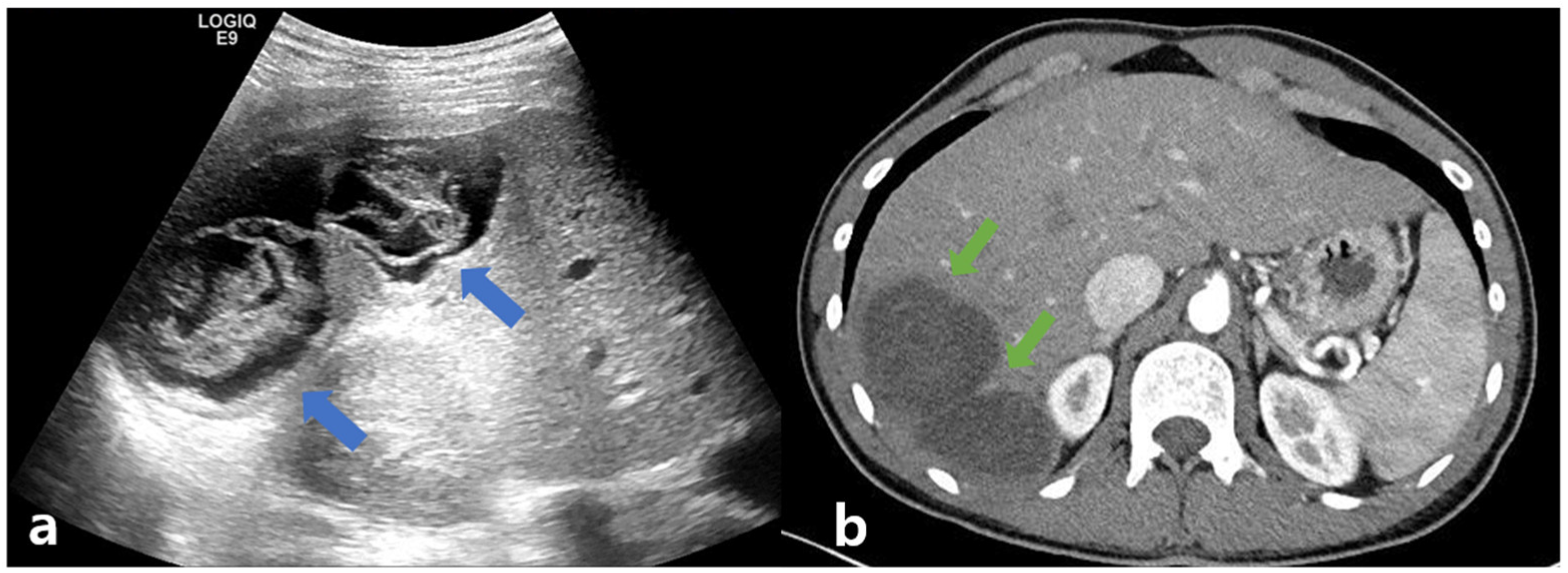 Tropicalmed 08 00155 g001