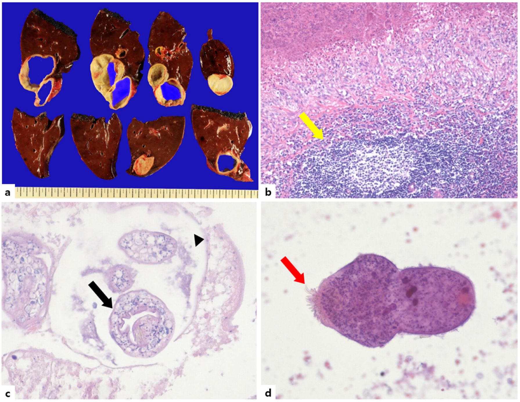 Tropicalmed 08 00155 g002