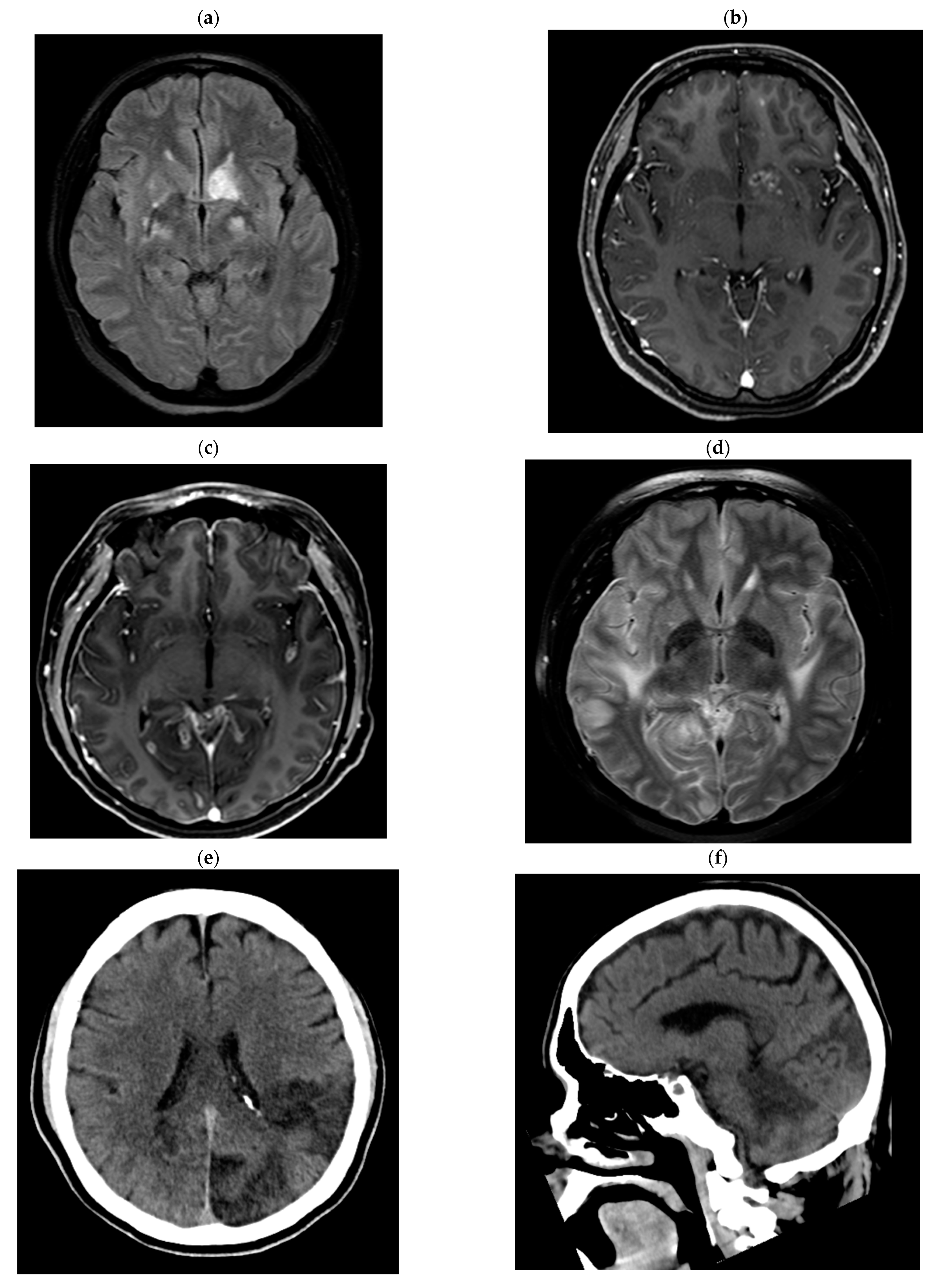 Tropicalmed 08 00182 g001a