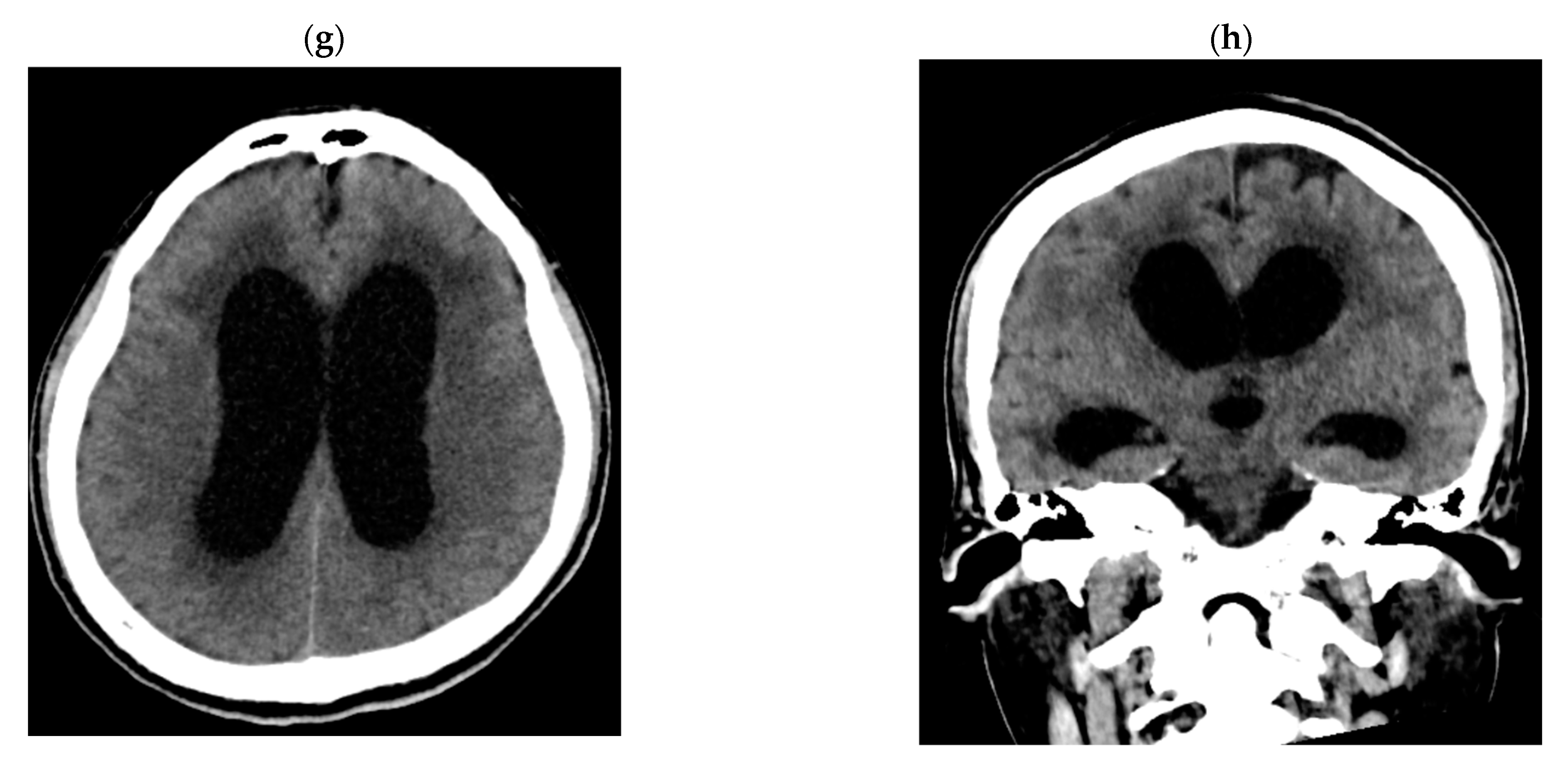 Tropicalmed 08 00182 g001b