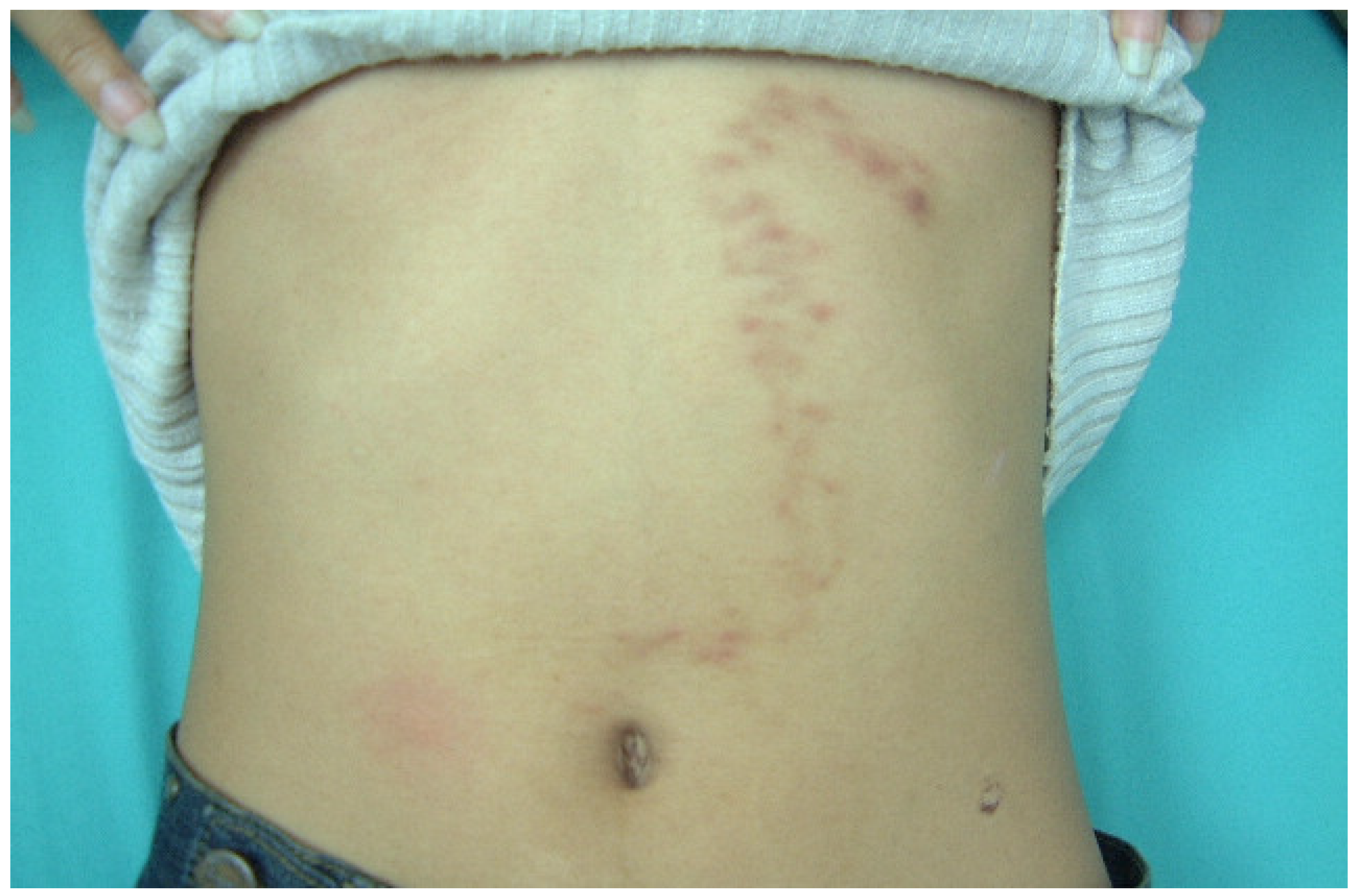 Tropicalmed 08 00209 g001