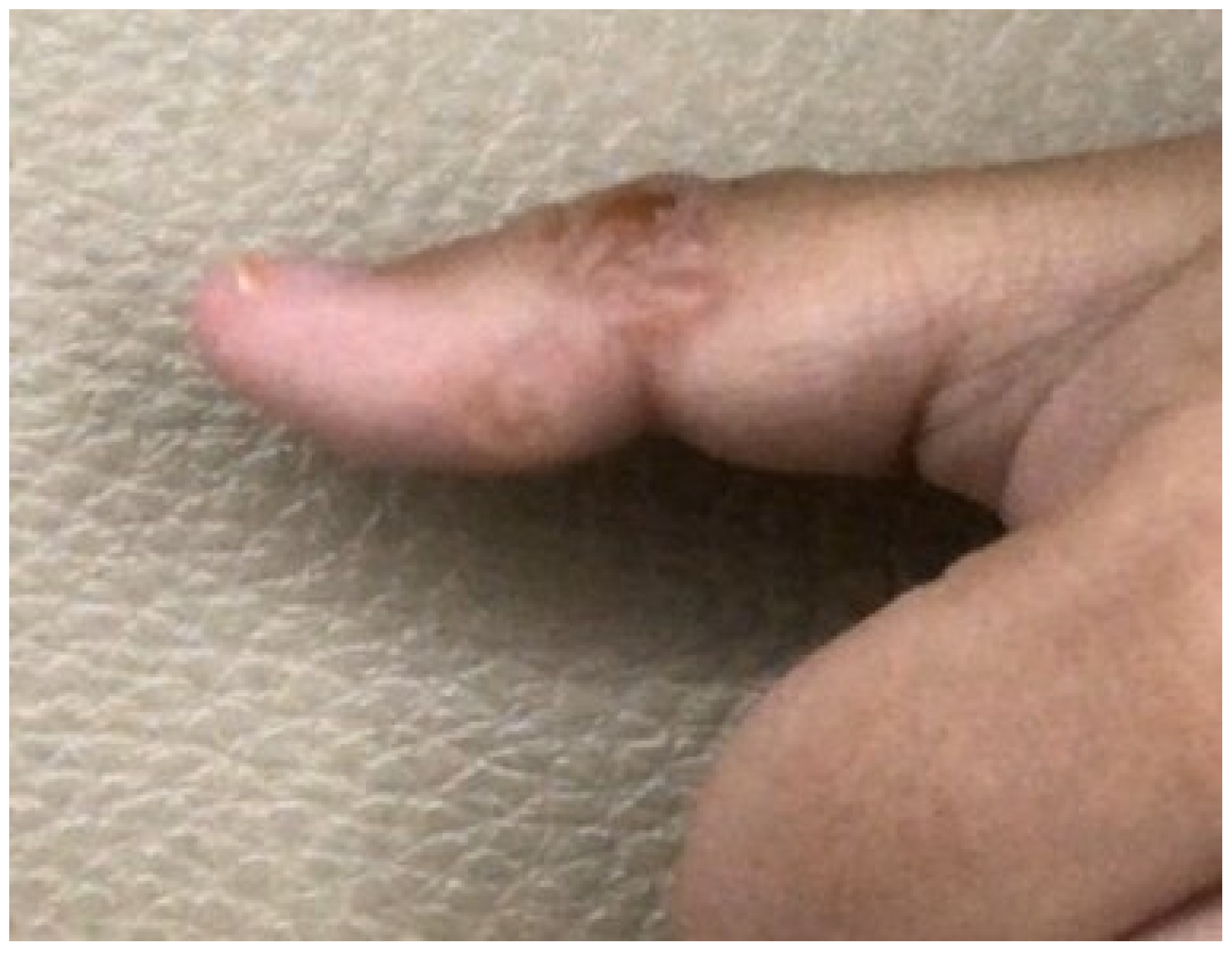 Tropicalmed 08 00209 g003