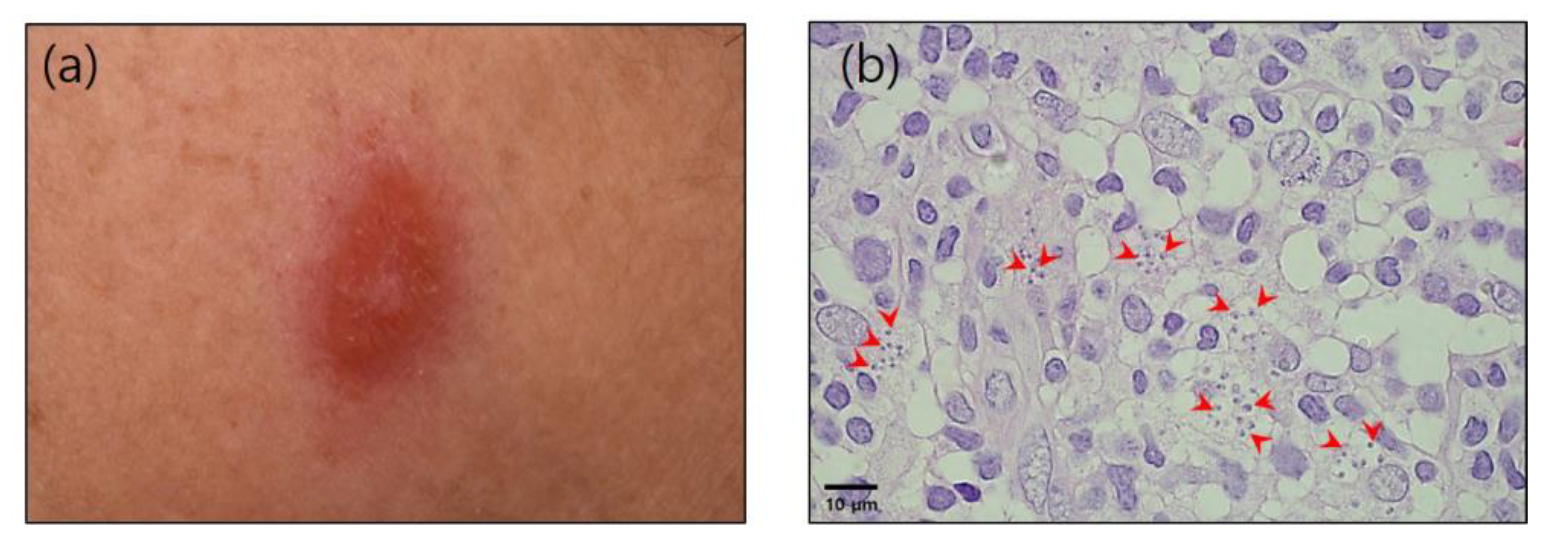 Tropicalmed 08 00223 g001