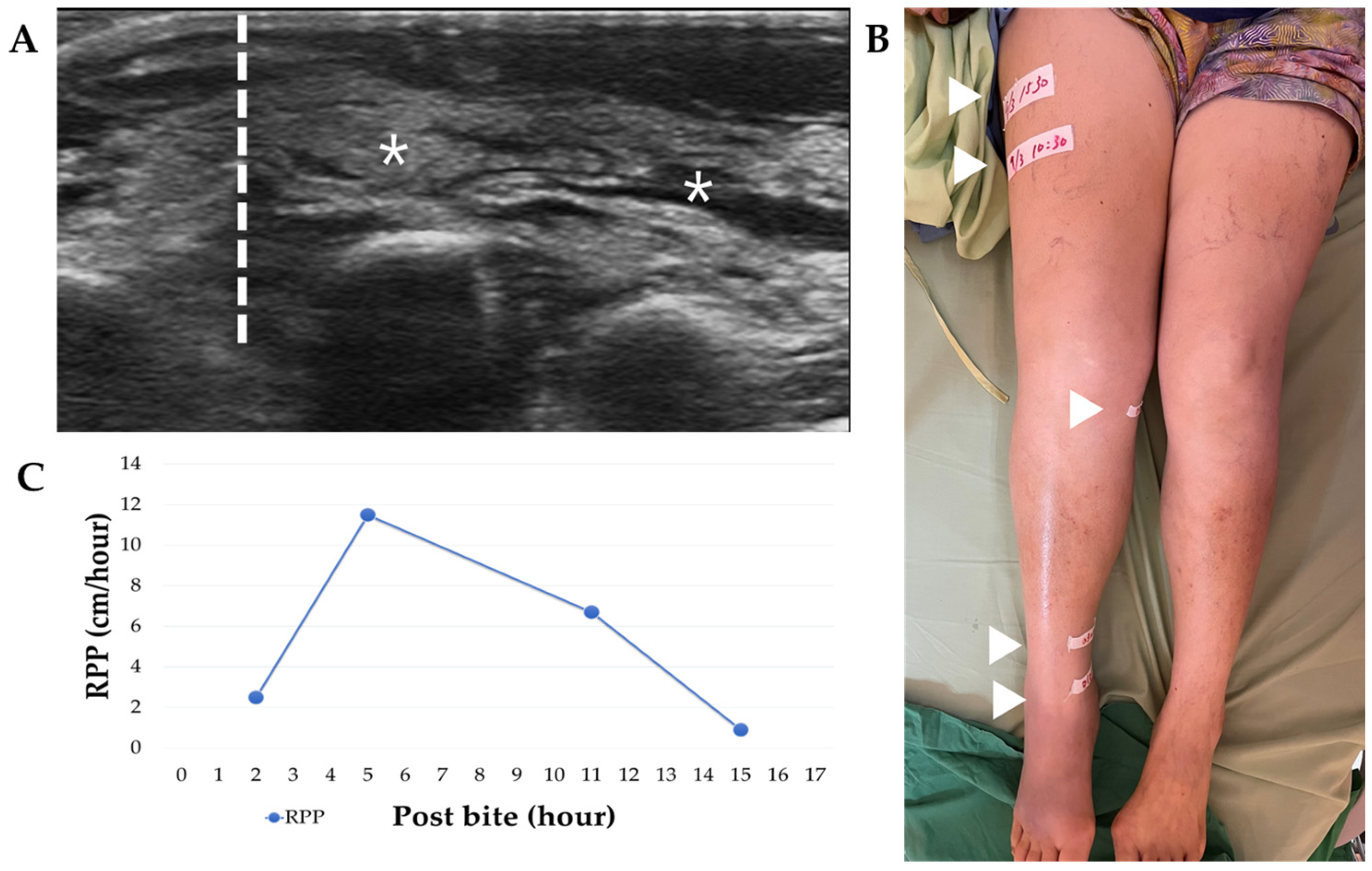 Tropicalmed 08 00246 g002