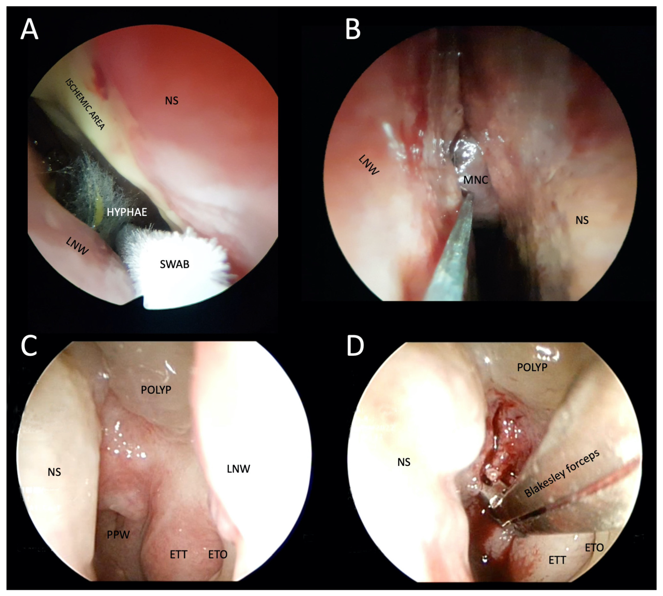 Tropicalmed 08 00254 g005 Tropicalmed 08 00254 g005