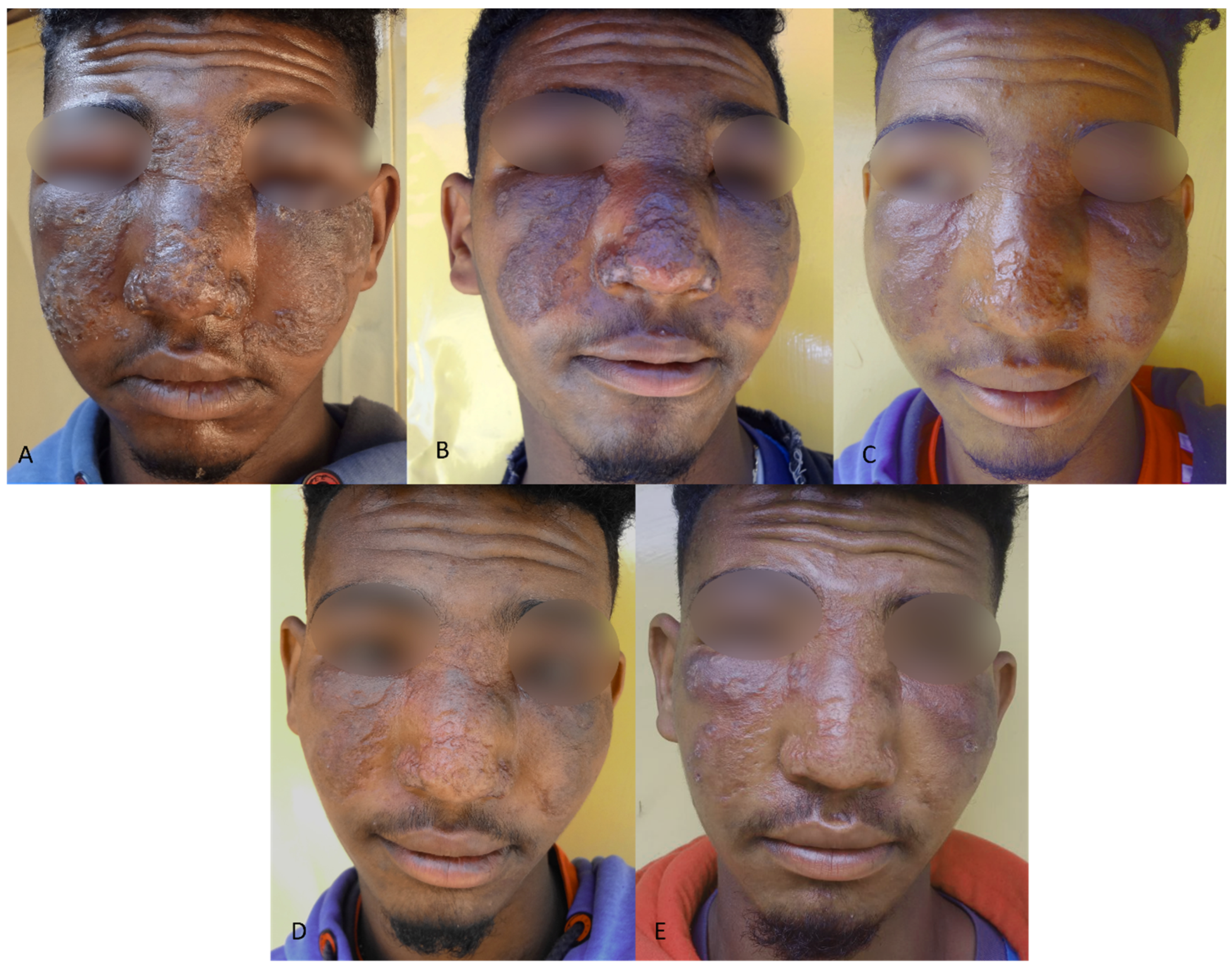 Tropicalmed 08 00414 g001