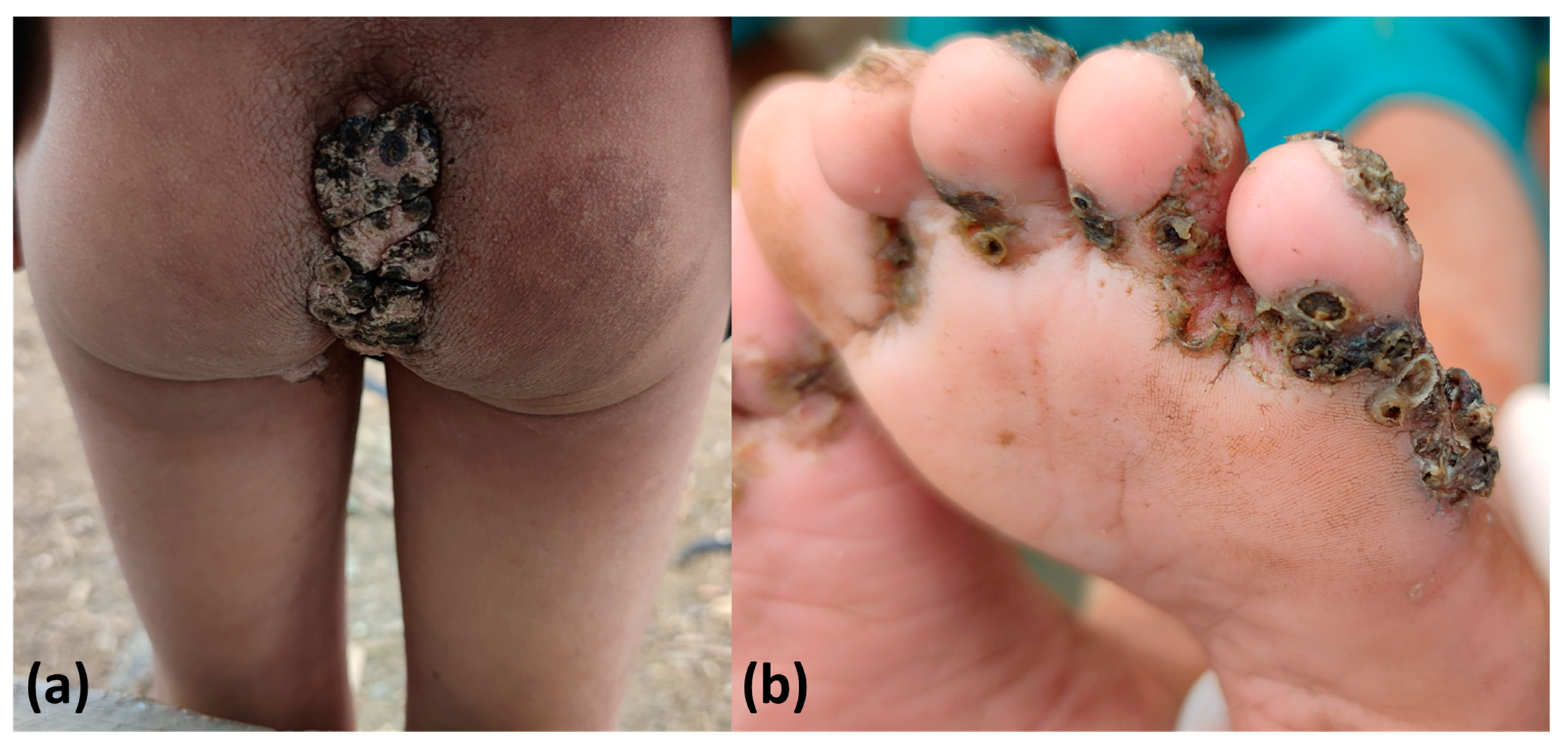 Tropicalmed 08 00489 g005