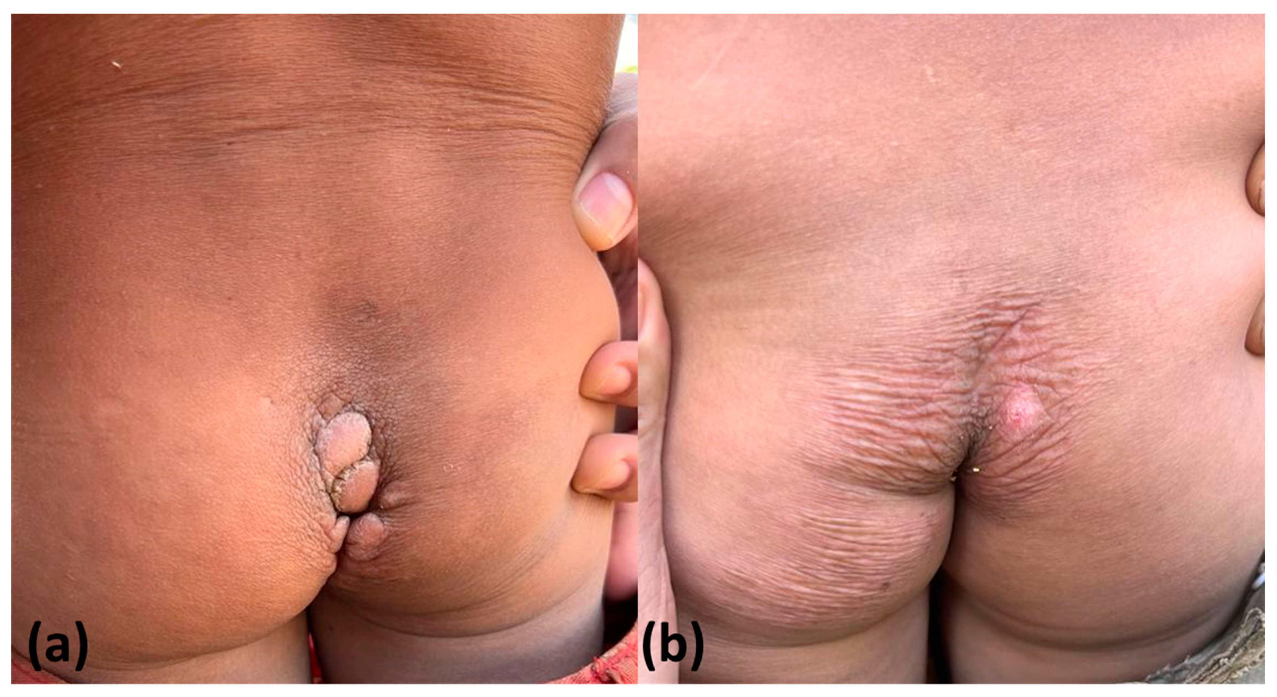 Tropicalmed 08 00489 g006