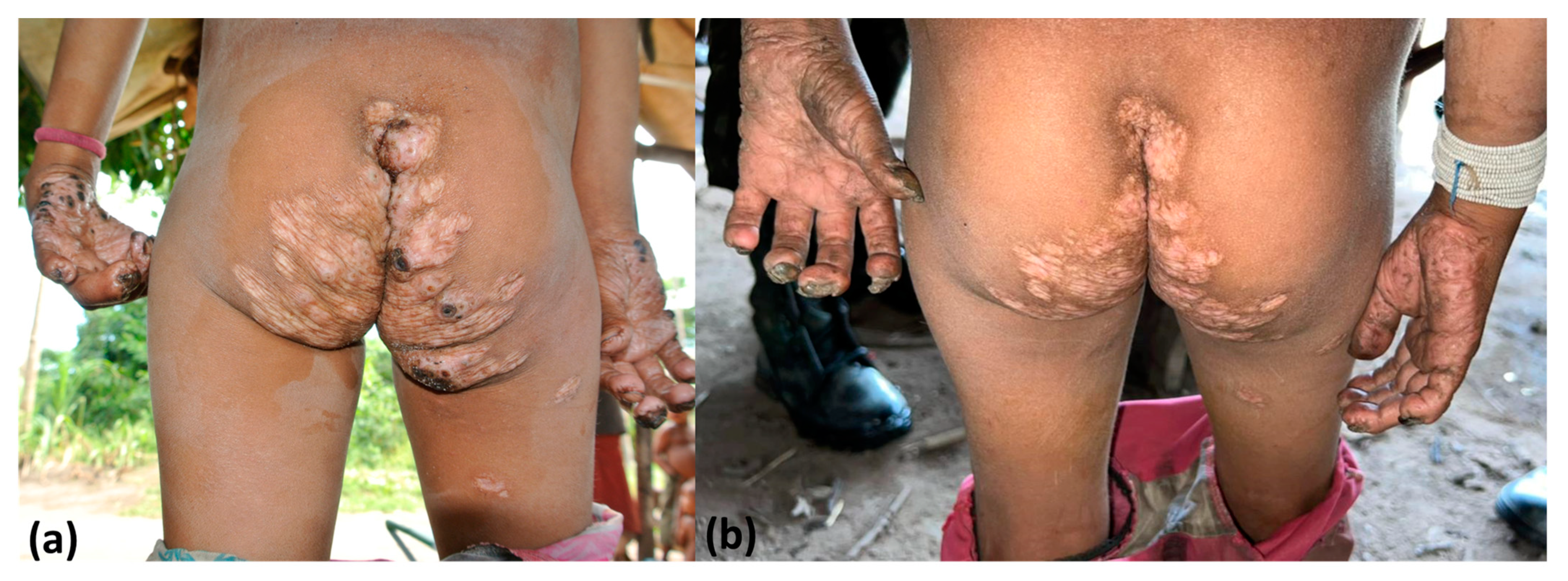 Tropicalmed 08 00489 g007