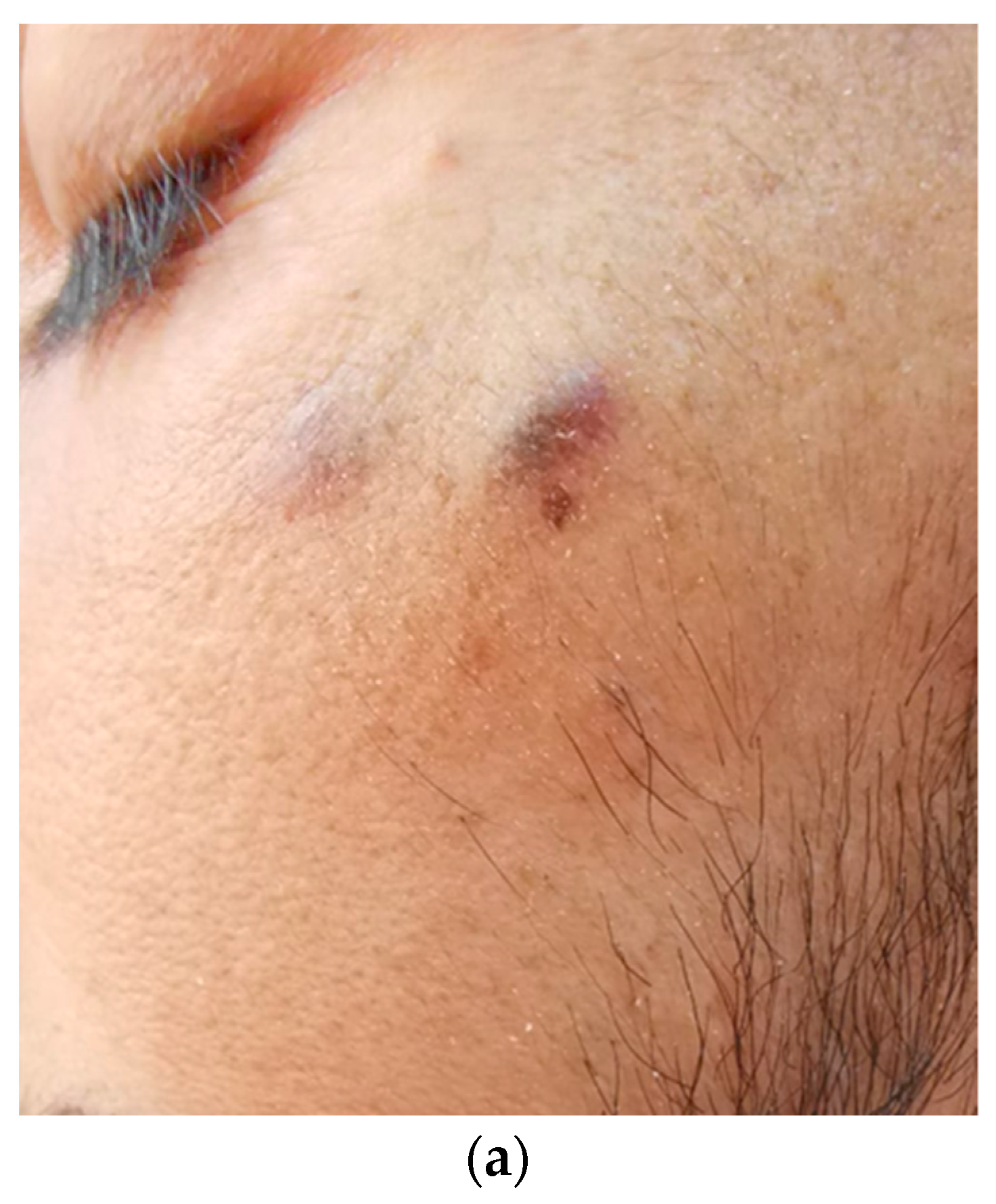 Tropicalmed 09 00047 g001a