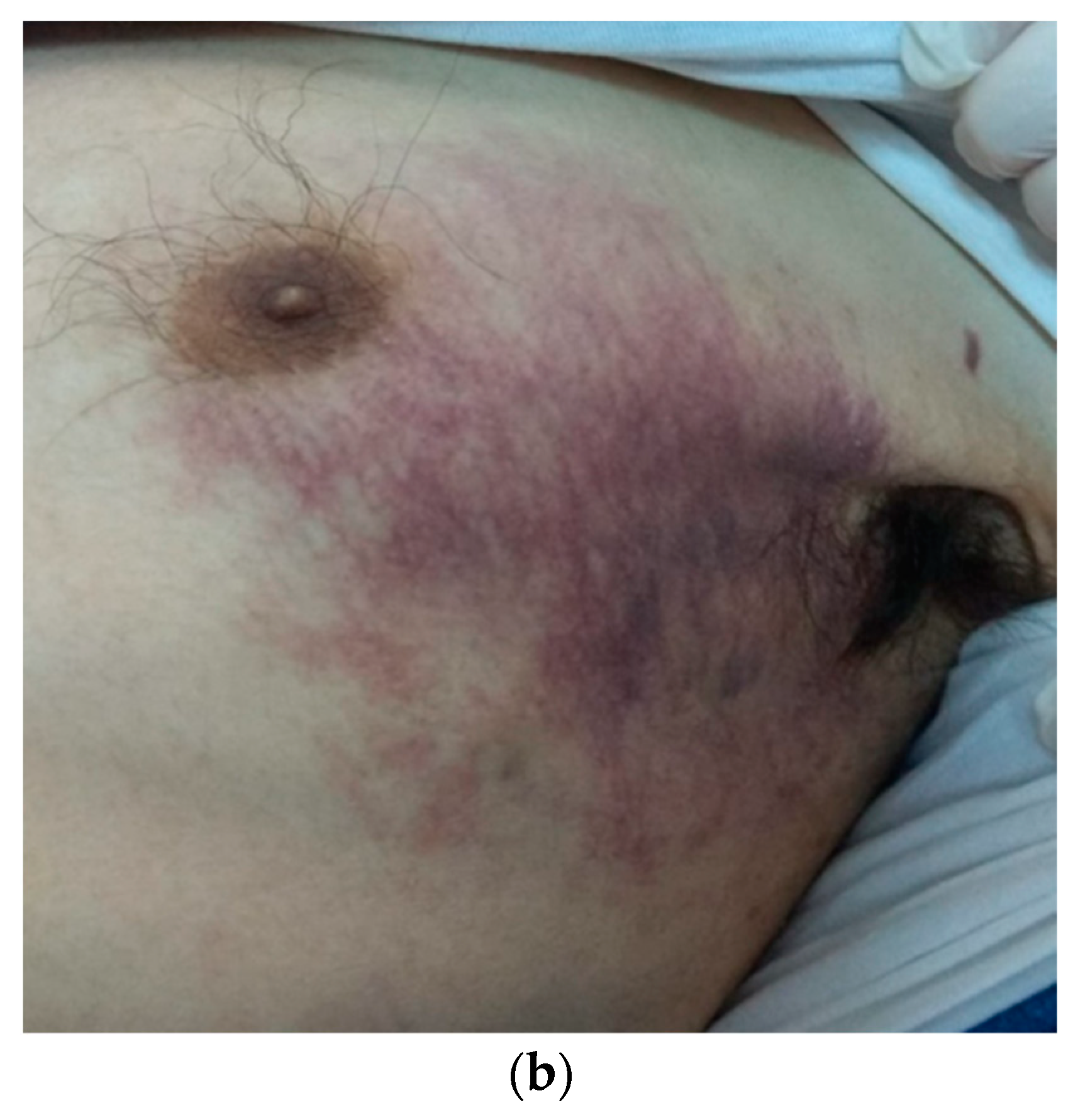 Tropicalmed 09 00047 g001b