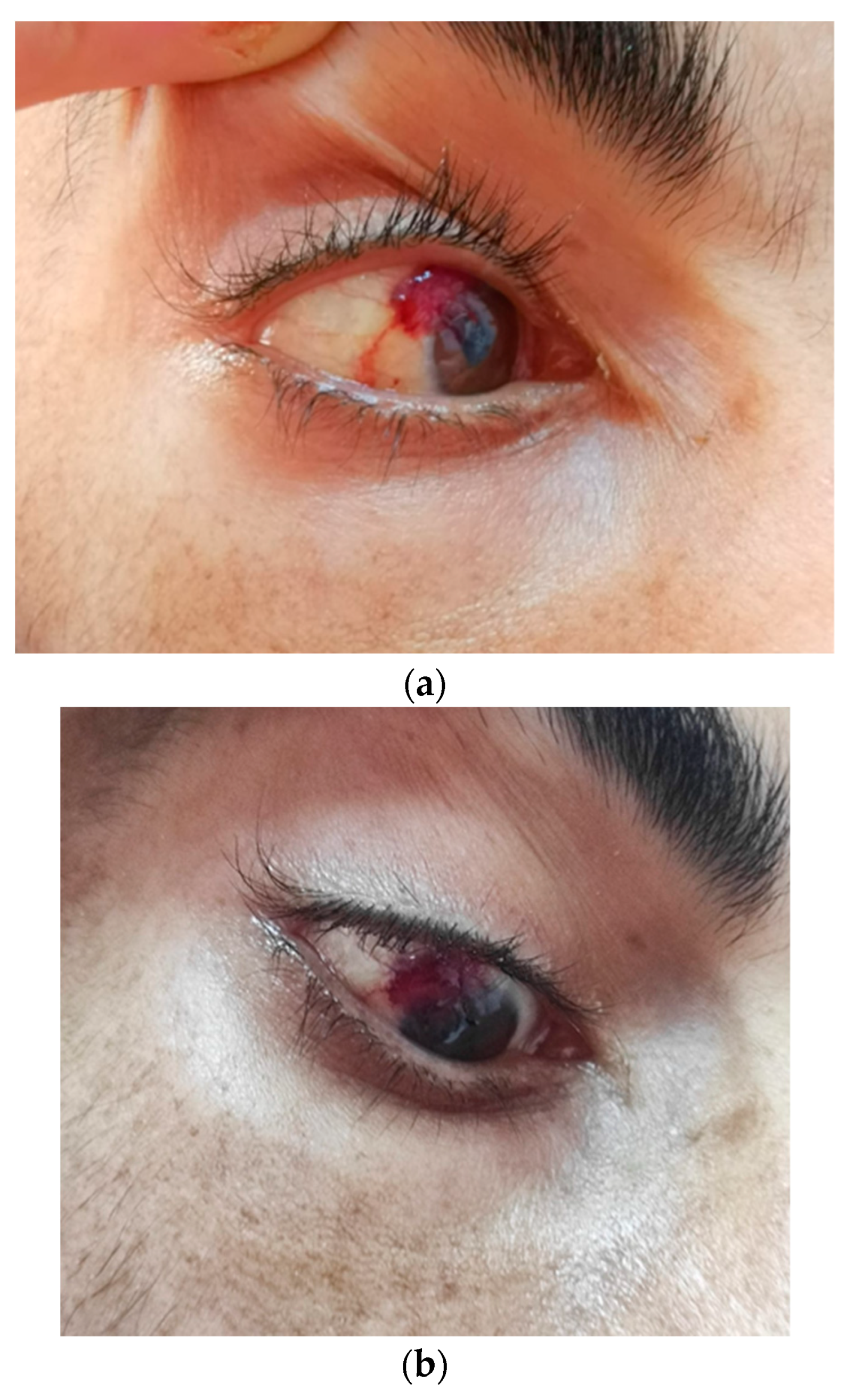 Tropicalmed 09 00047 g002