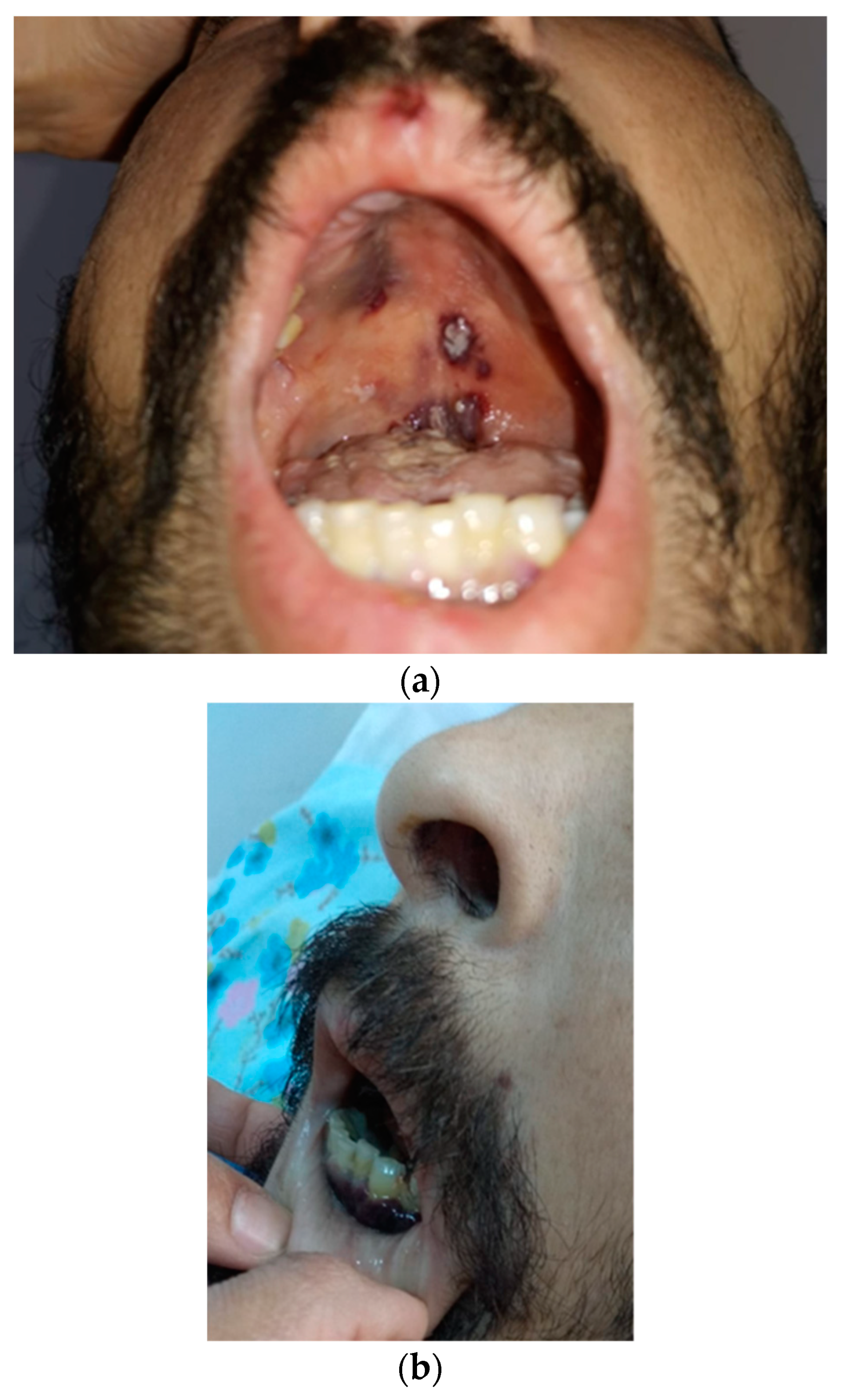 Tropicalmed 09 00047 g003