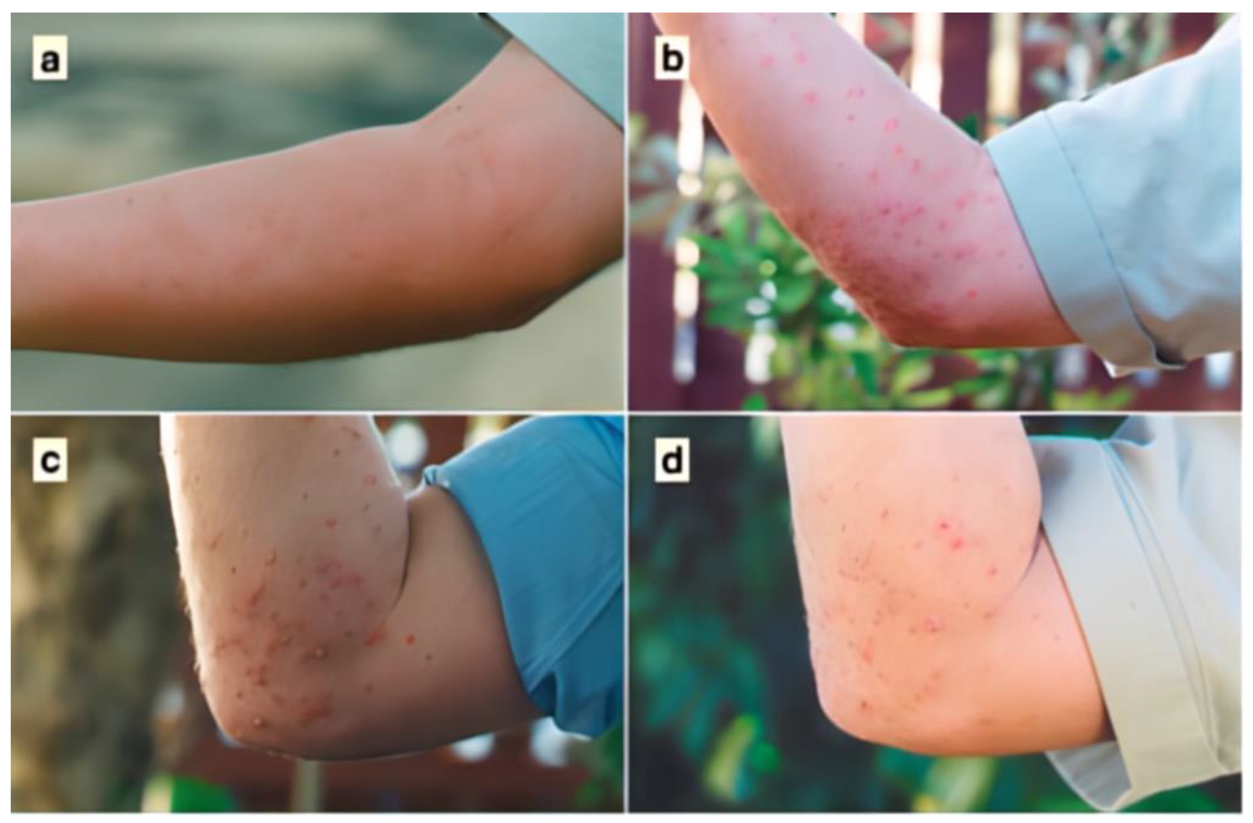 Tropicalmed 09 00069 g002