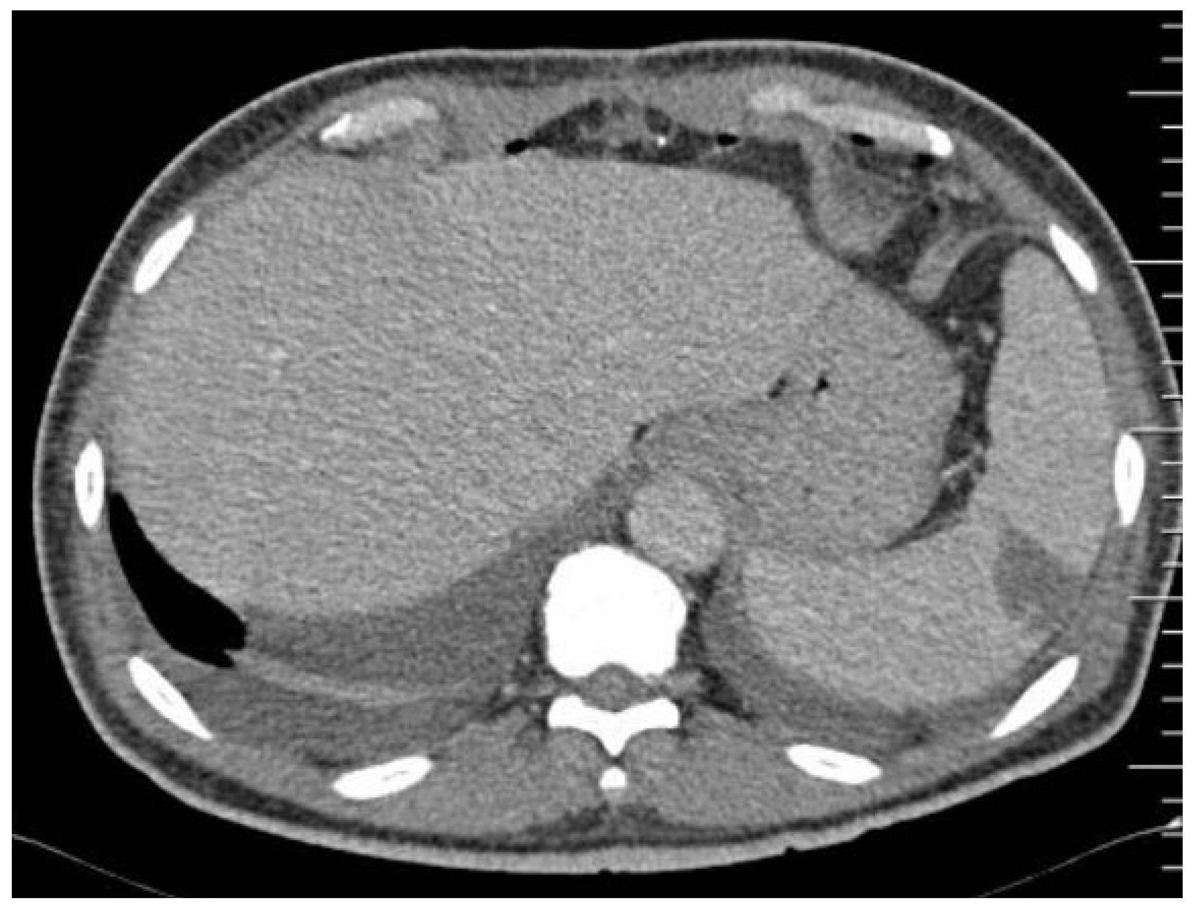 Tropicalmed 09 00083 g001