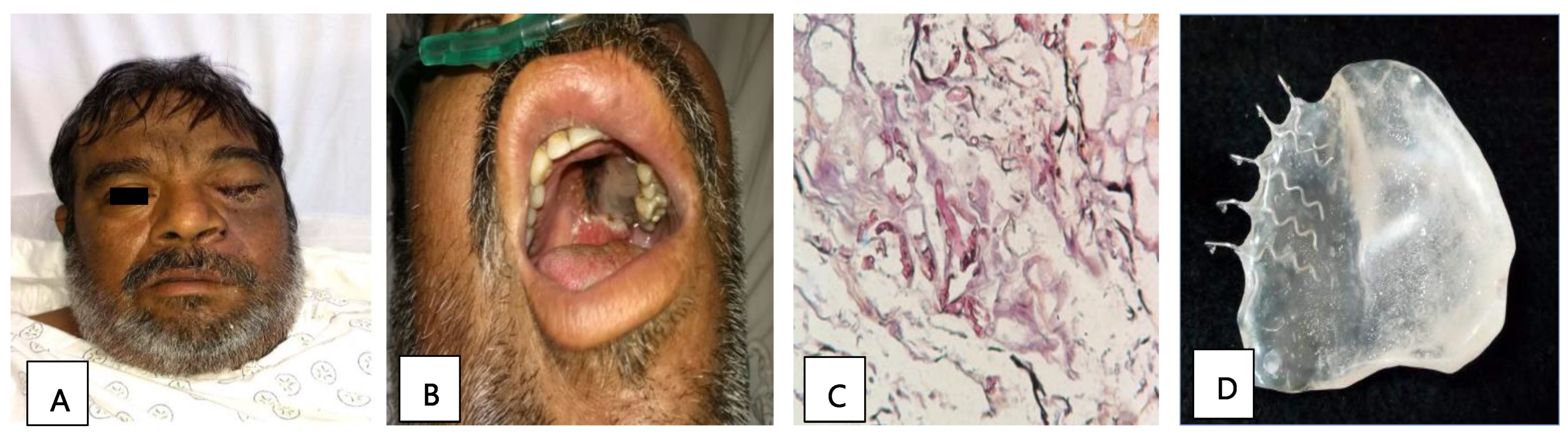 Tropicalmed 09 00158 g001