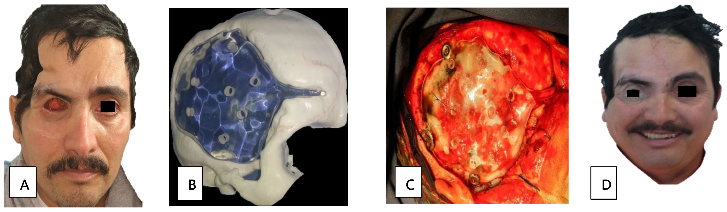 Tropicalmed 09 00158 g003