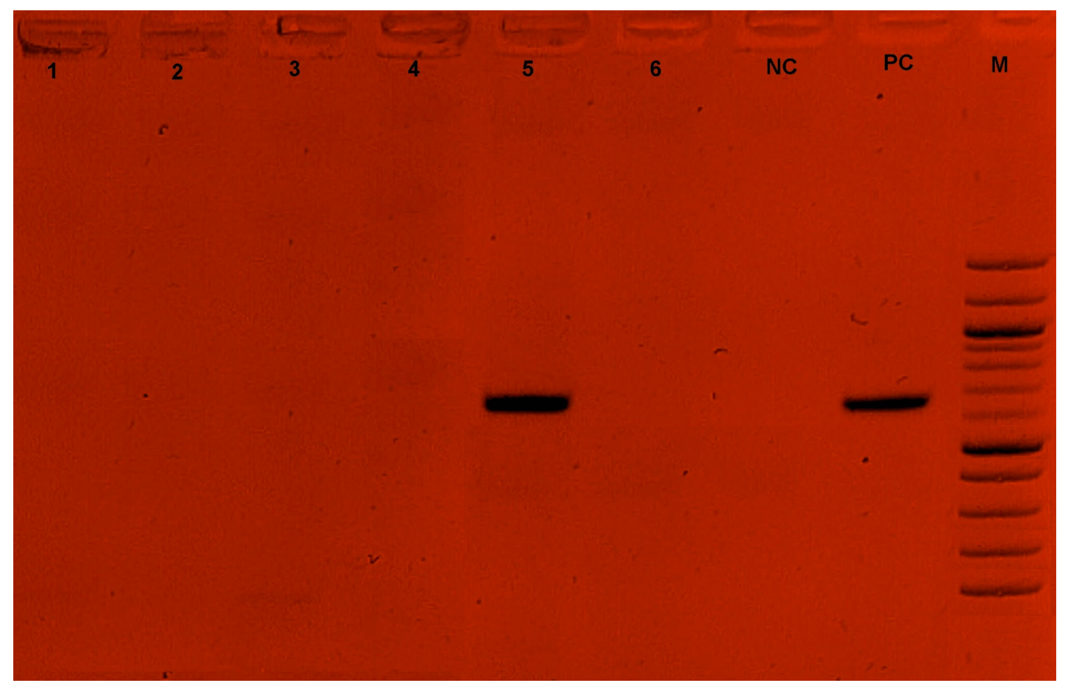 Tropicalmed 09 00192 g004 Tropicalmed 09 00192 g004