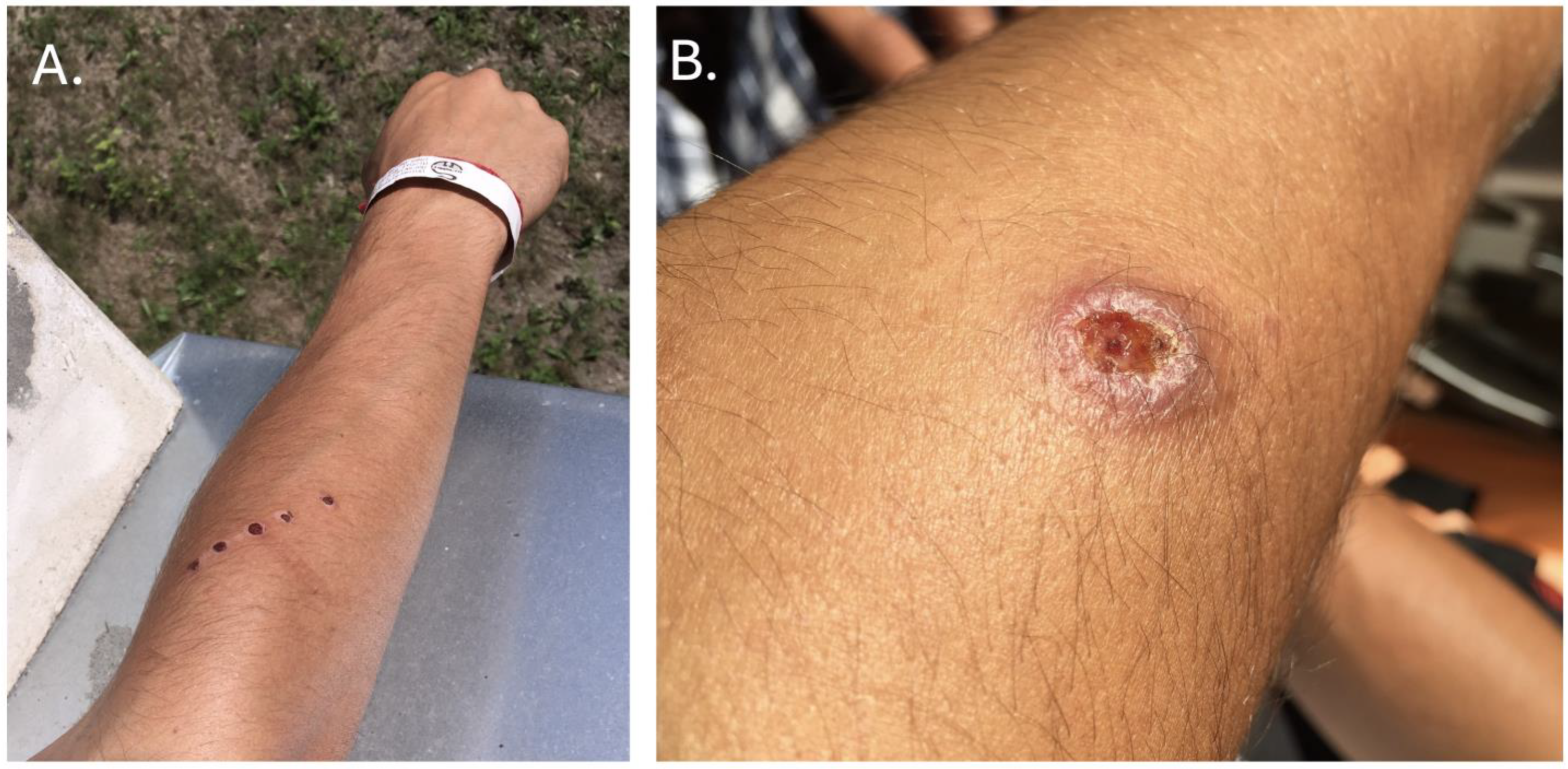 Tropicalmed 09 00227 g001