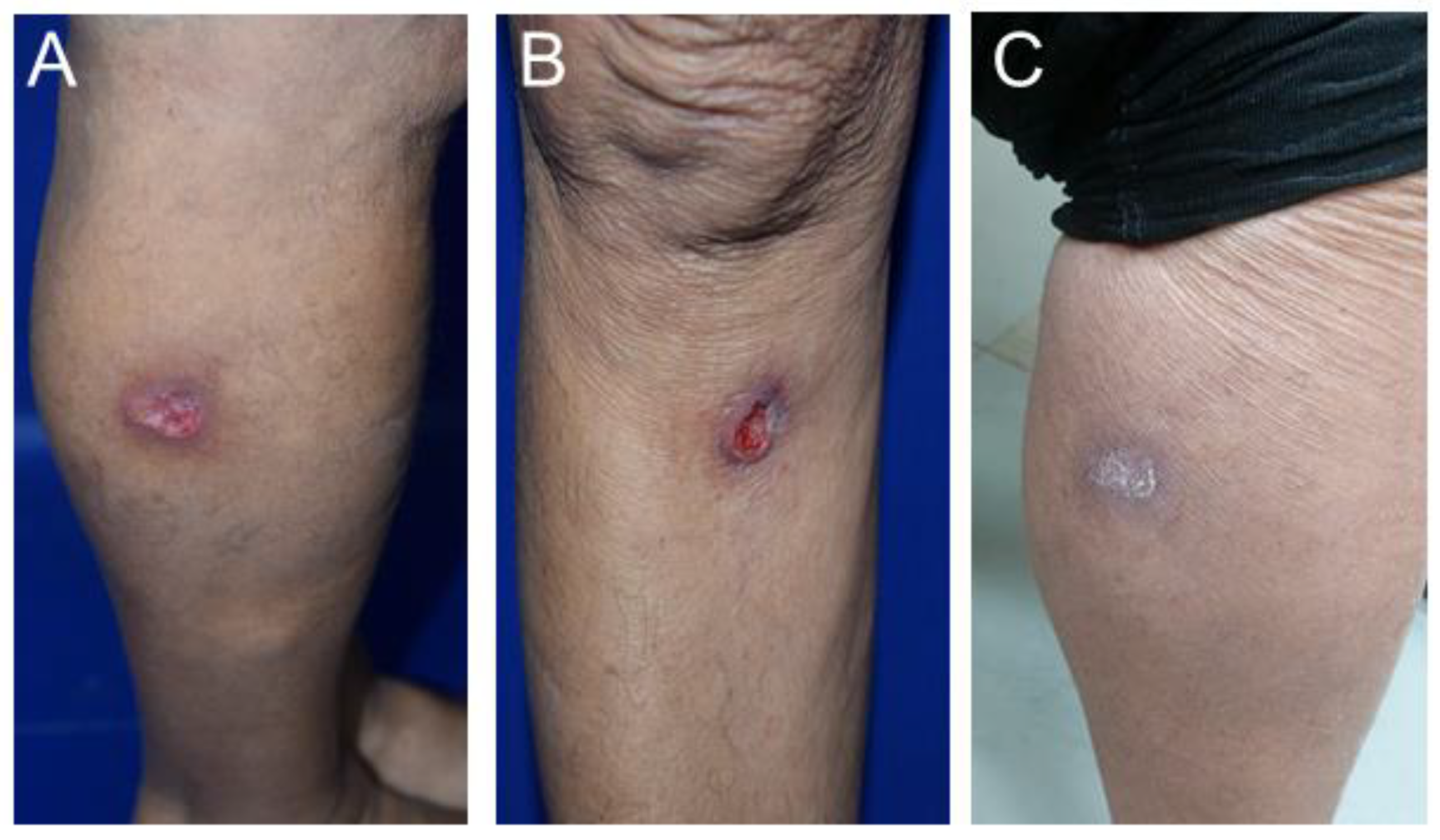 Tropicalmed 09 00264 g001