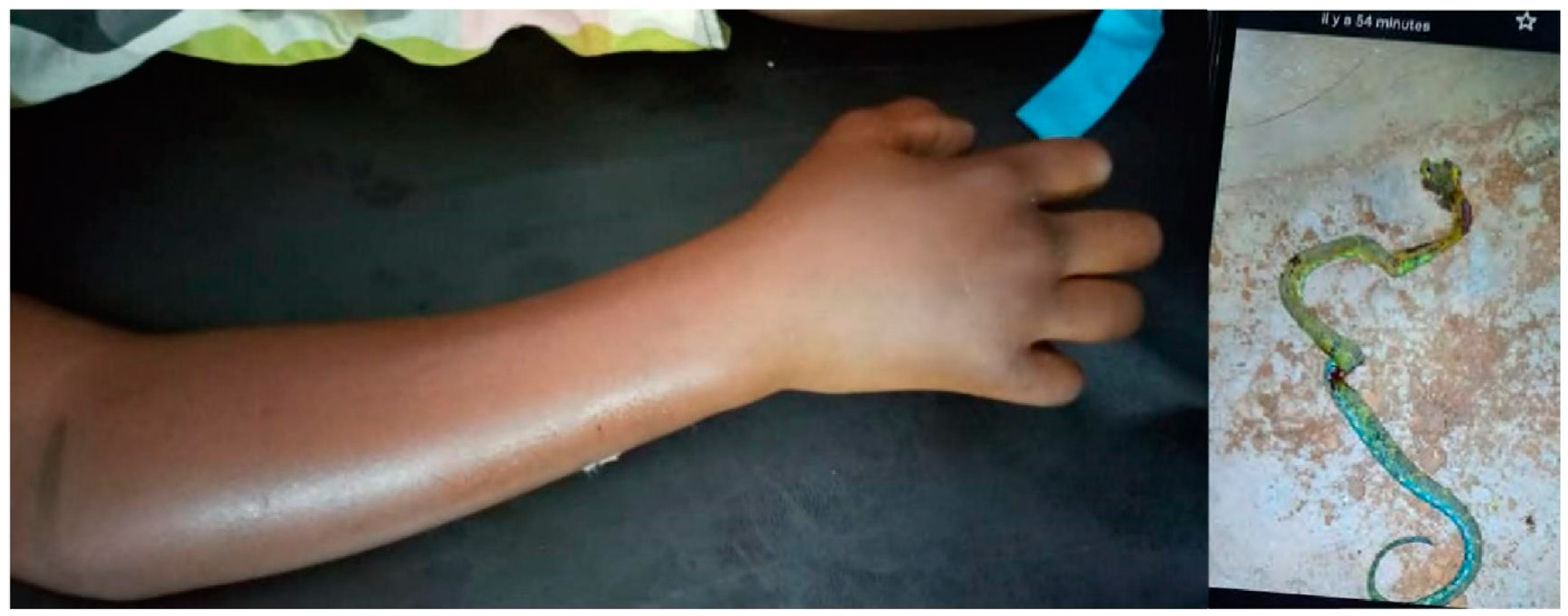 Tropicalmed 09 00300 g003 Tropicalmed 09 00300 g003