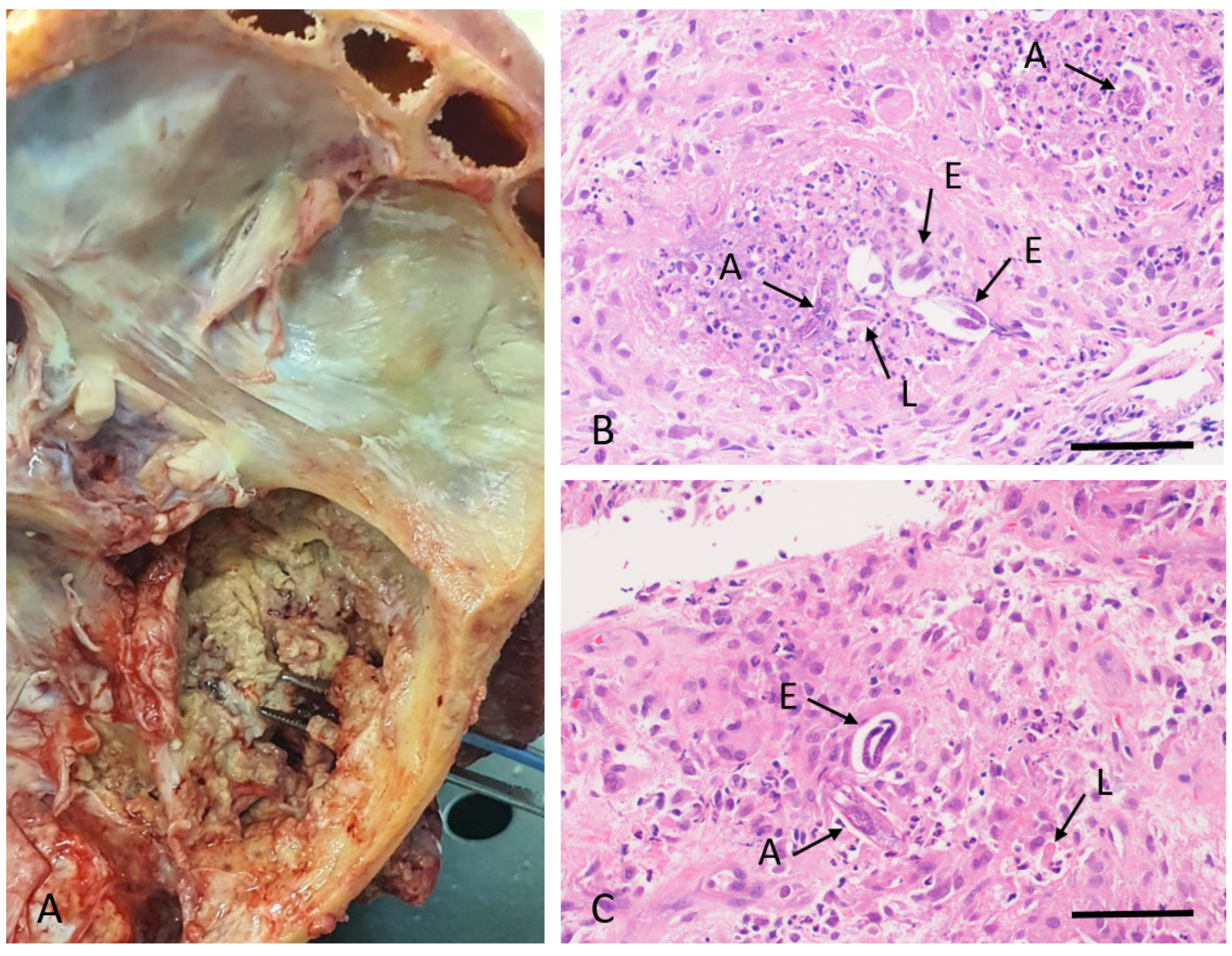 Tropicalmed 10 00037 g002