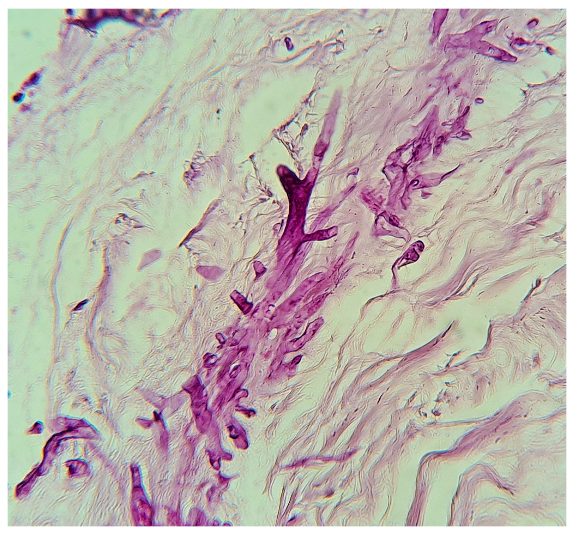 Tropicalmed 10 00086 g008