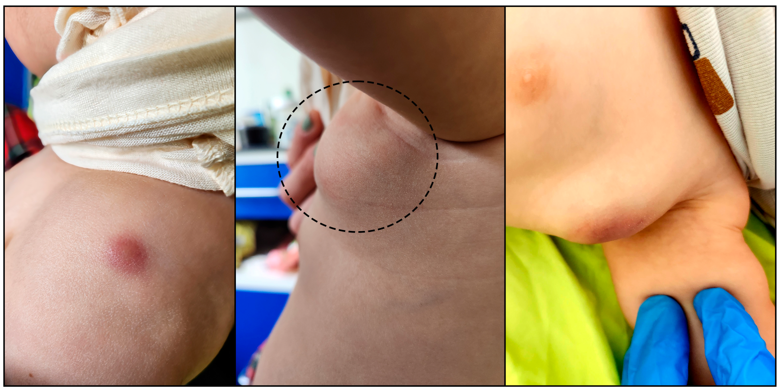 Tropicalmed 10 00148 g001