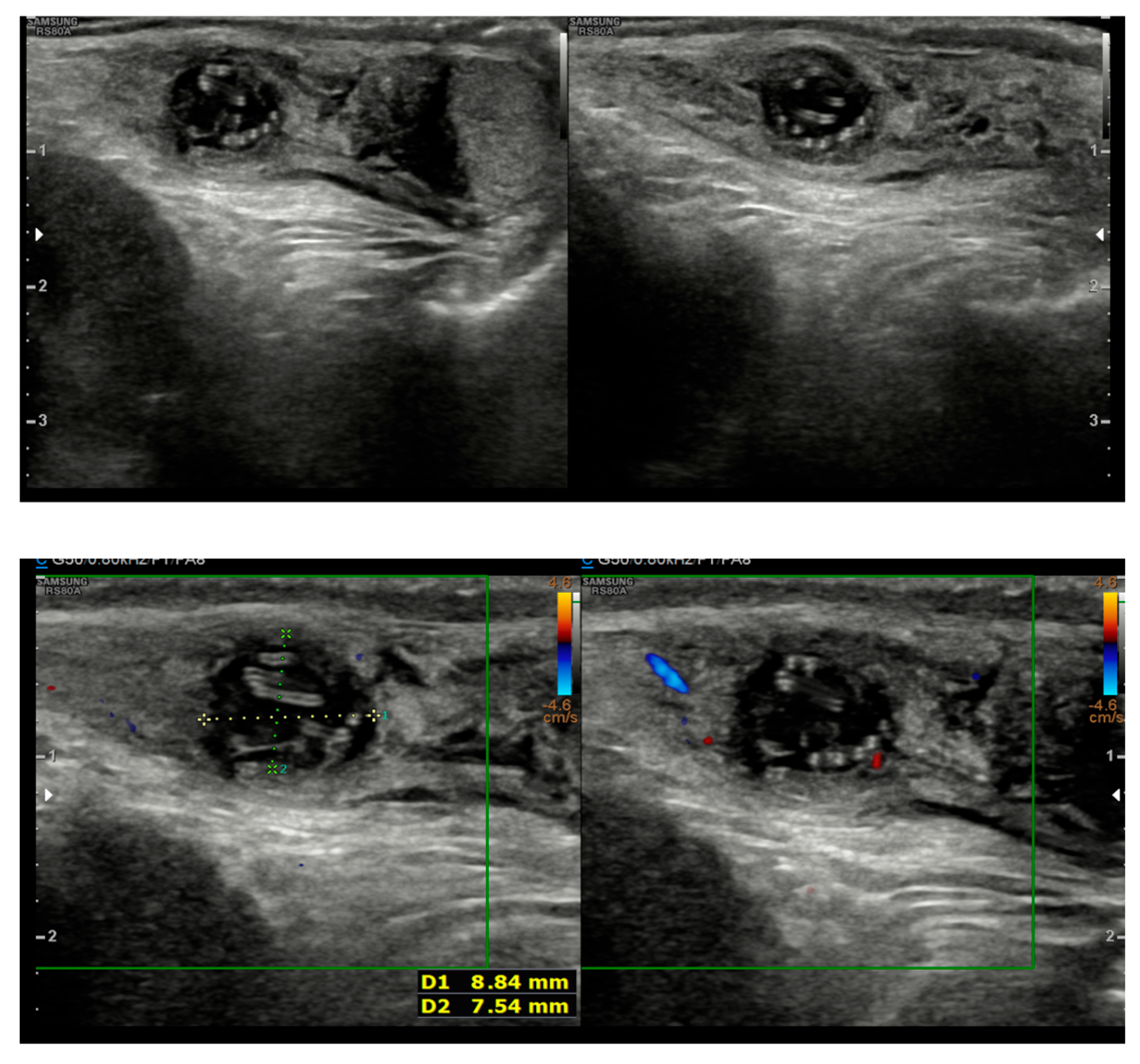 Tropicalmed 10 00184 g002