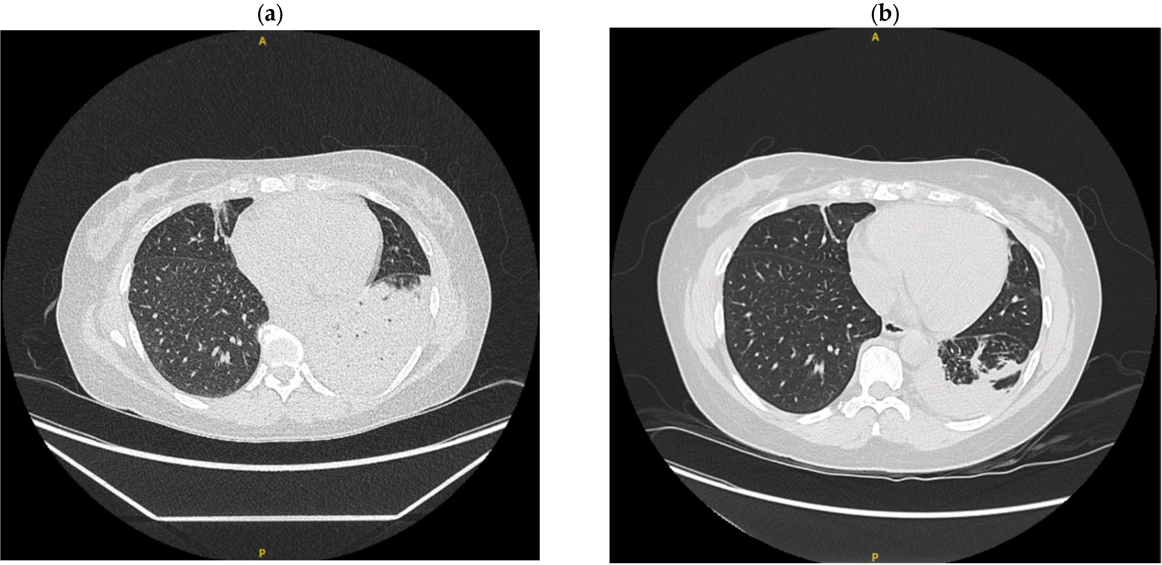 Tropicalmed 10 00202 g003