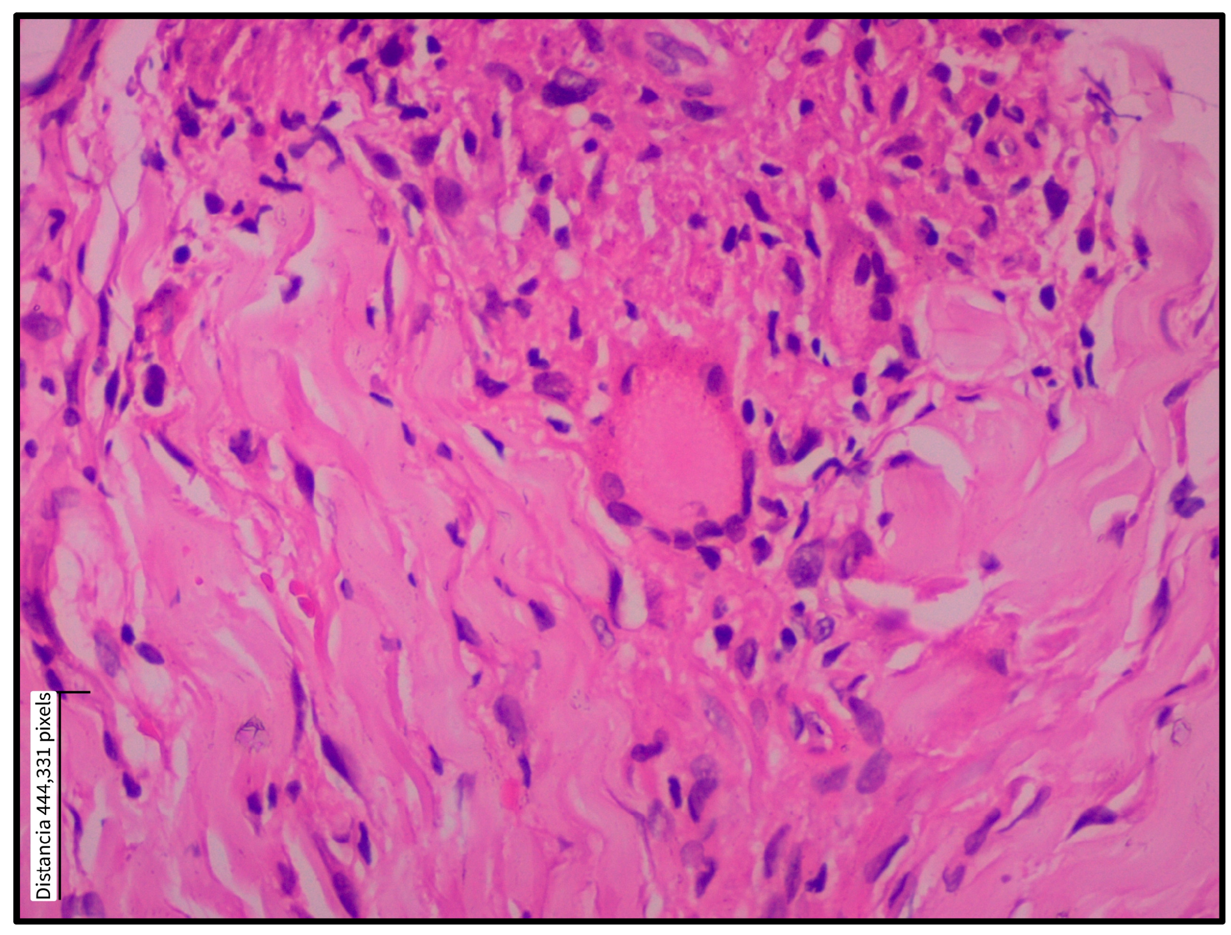 Tropicalmed 10 00232 g003