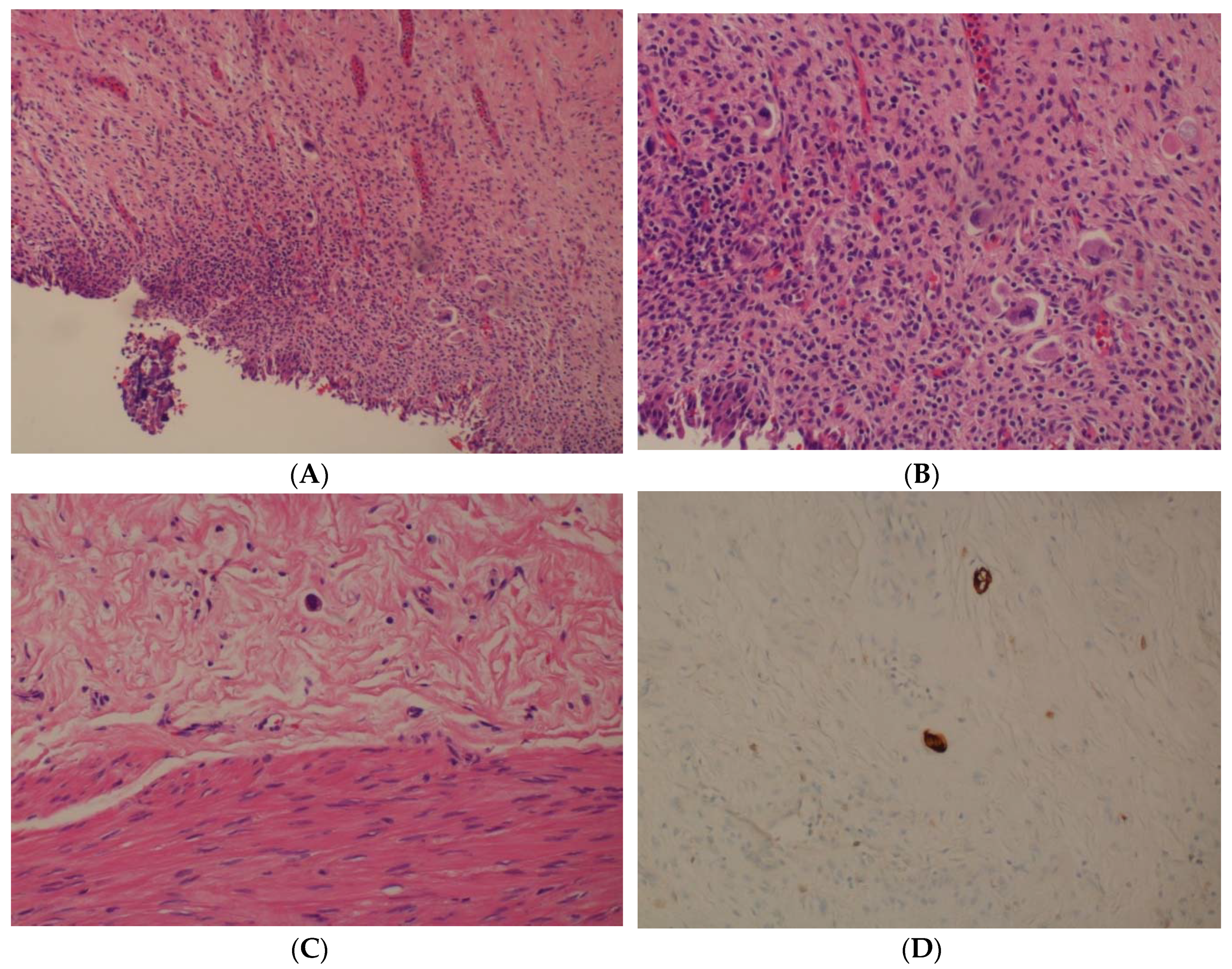Uro 01 00004 g001 Uro 01 00004 g001