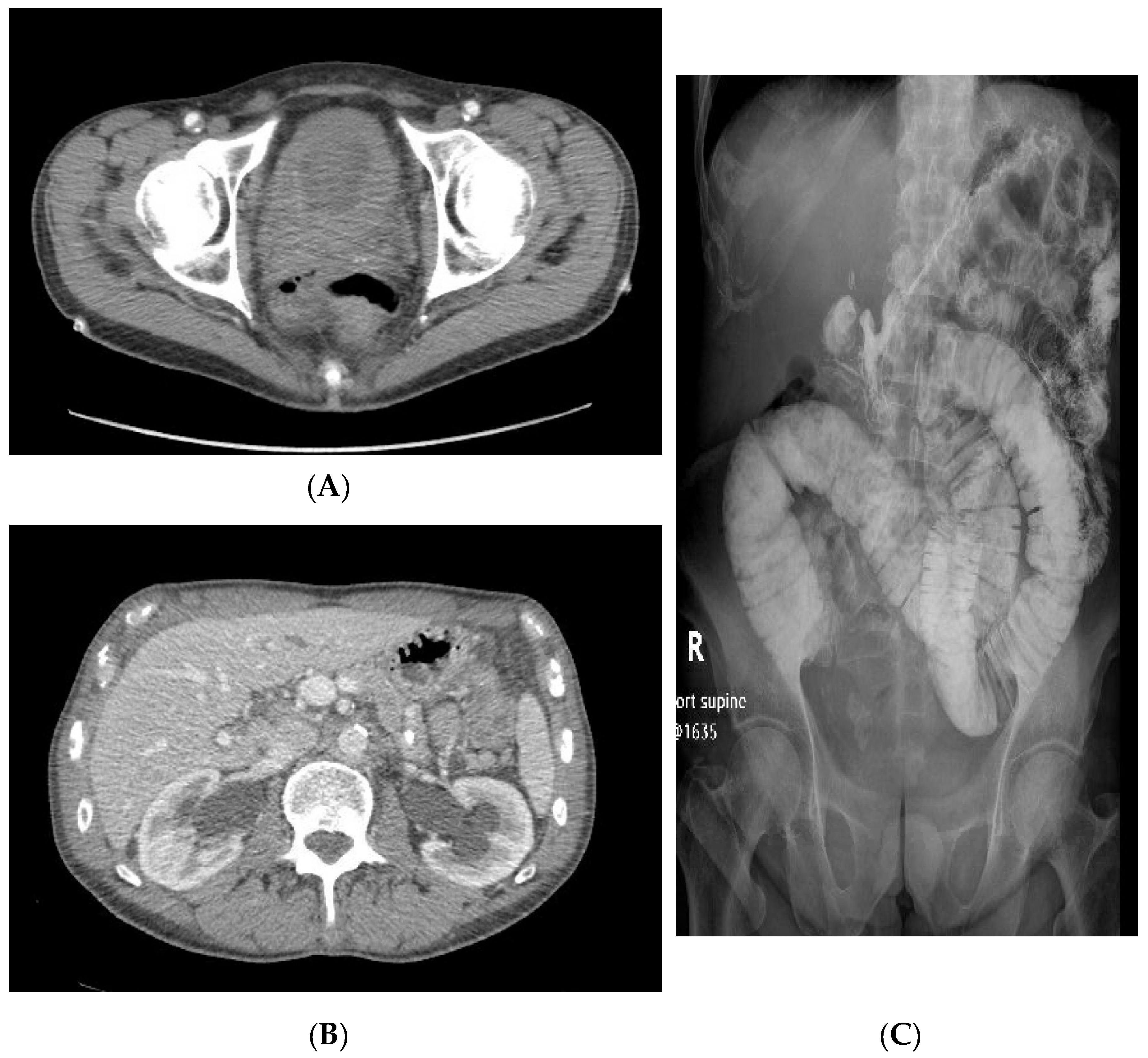 Uro 01 00004 g002 Uro 01 00004 g002