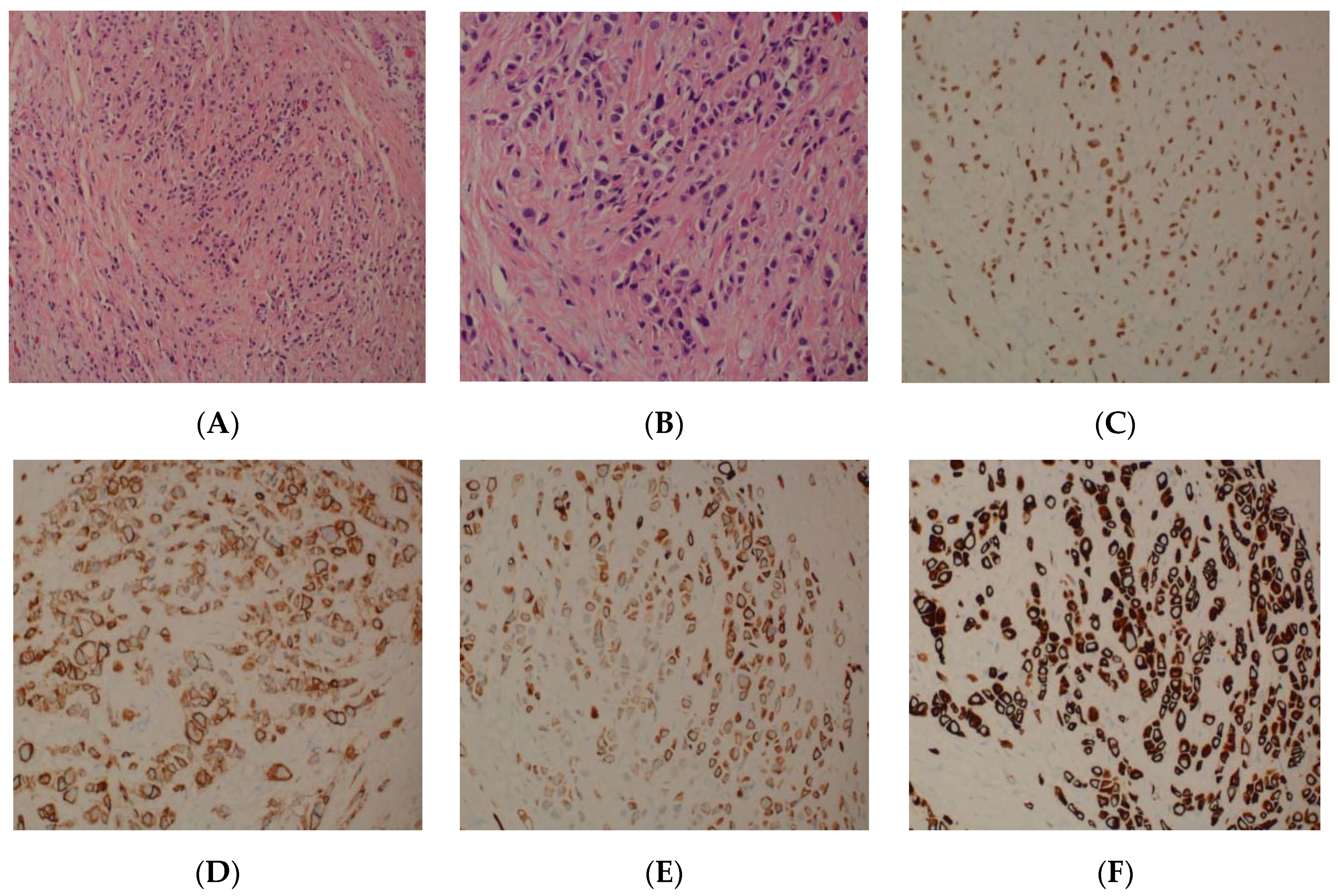 Uro 01 00004 g003 Uro 01 00004 g003