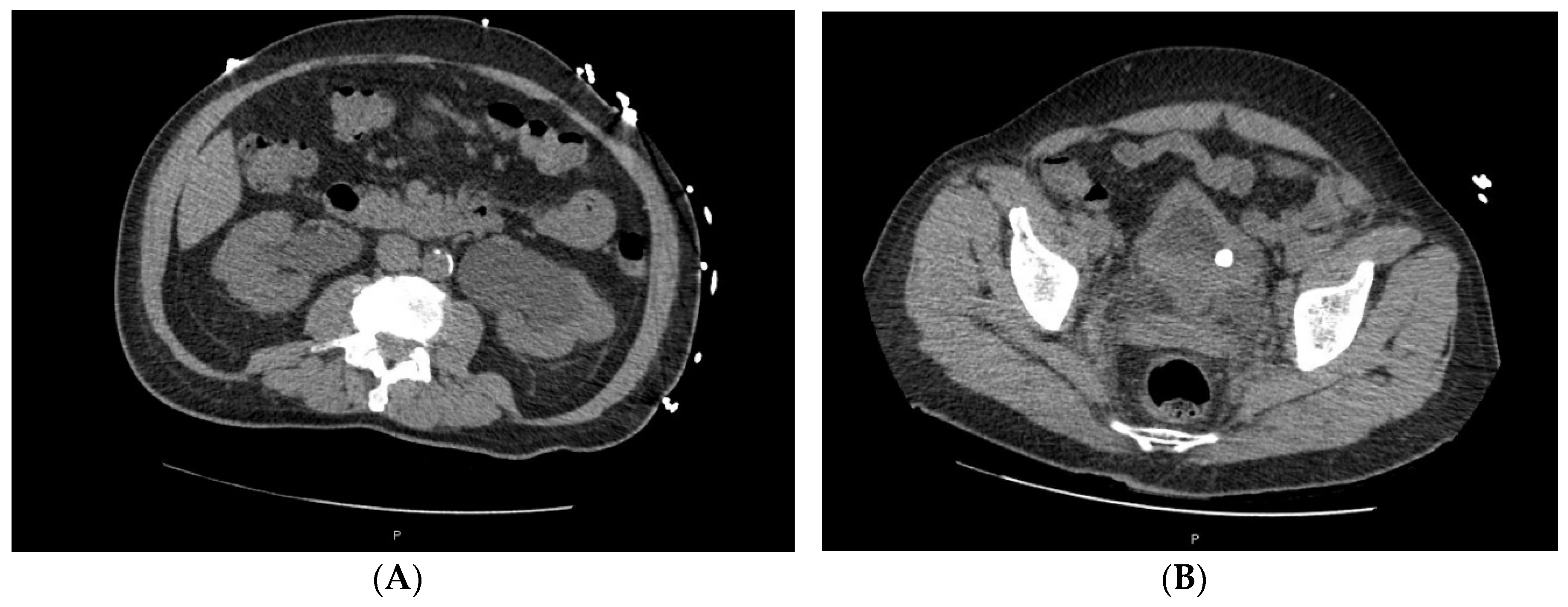 Uro 01 00004 g004 Uro 01 00004 g004