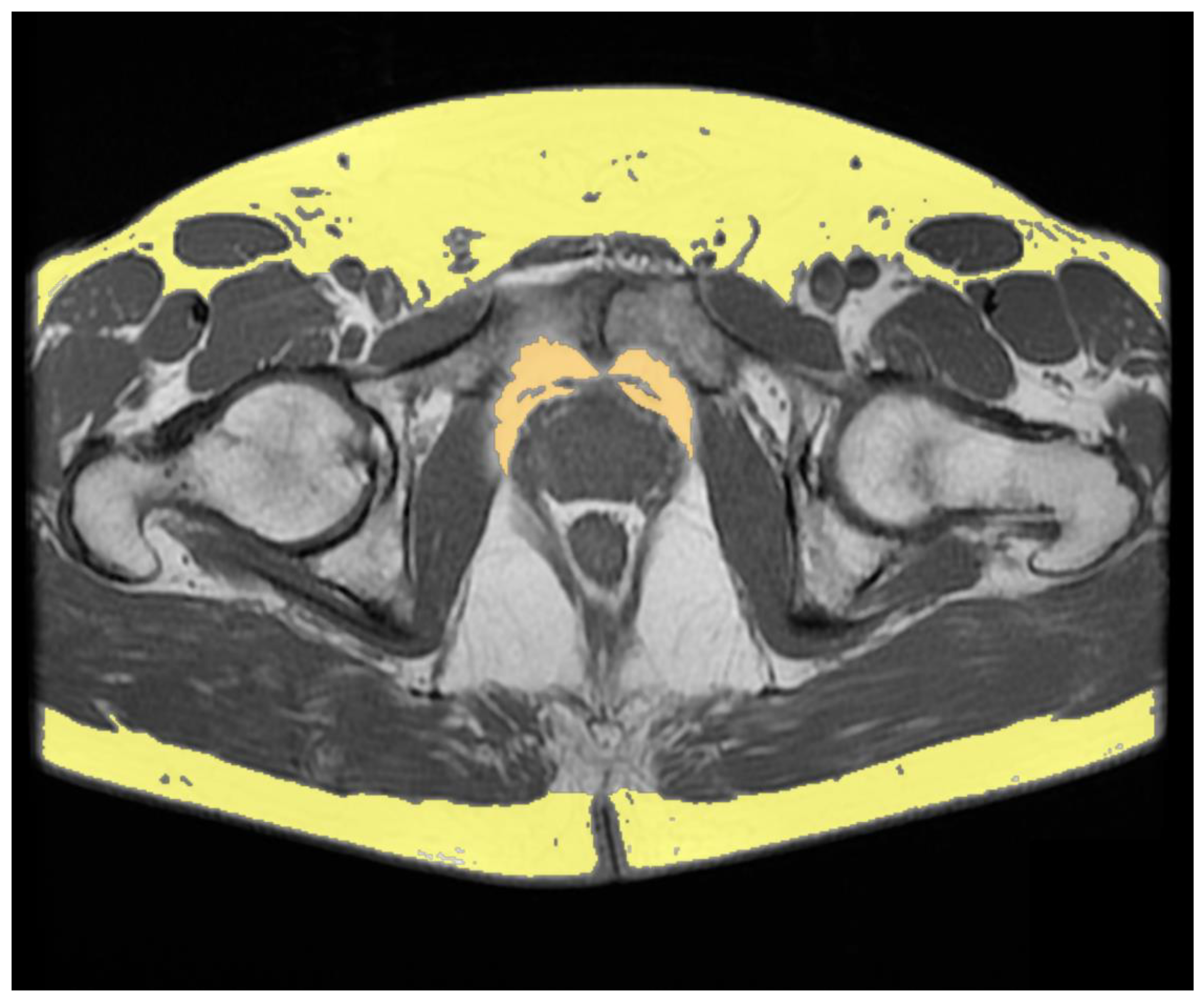 Uro 02 00030 g002 Uro 02 00030 g002