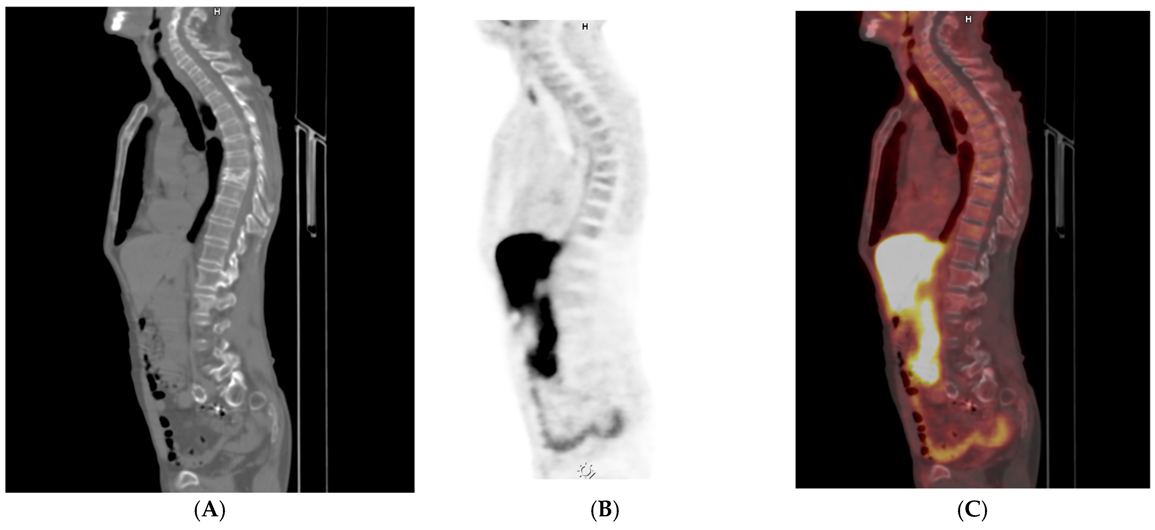 Uro 06 00017 g002