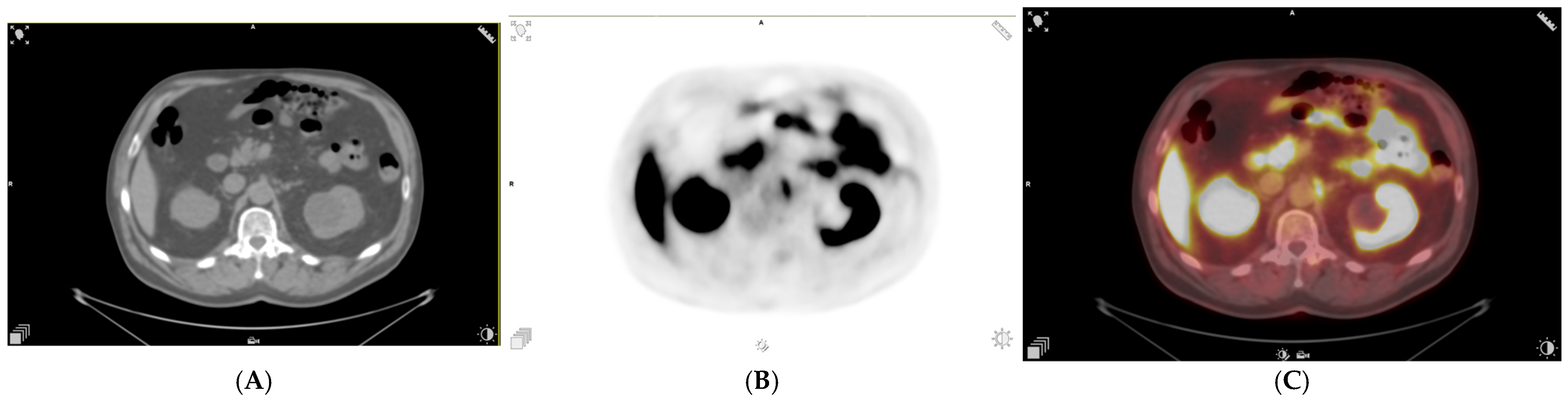 Uro 06 00017 g003