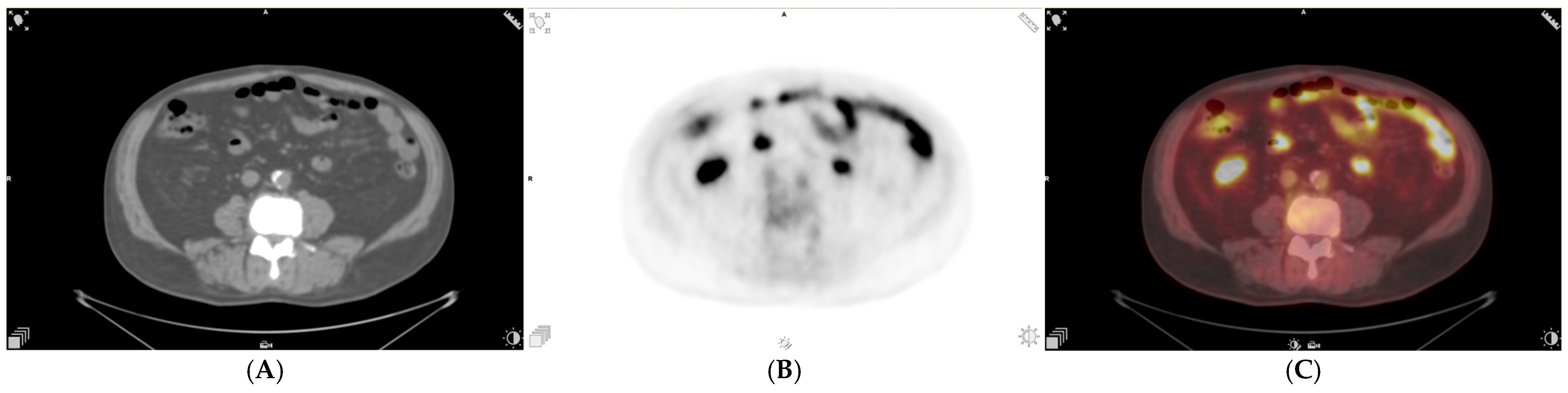 Uro 06 00017 g004