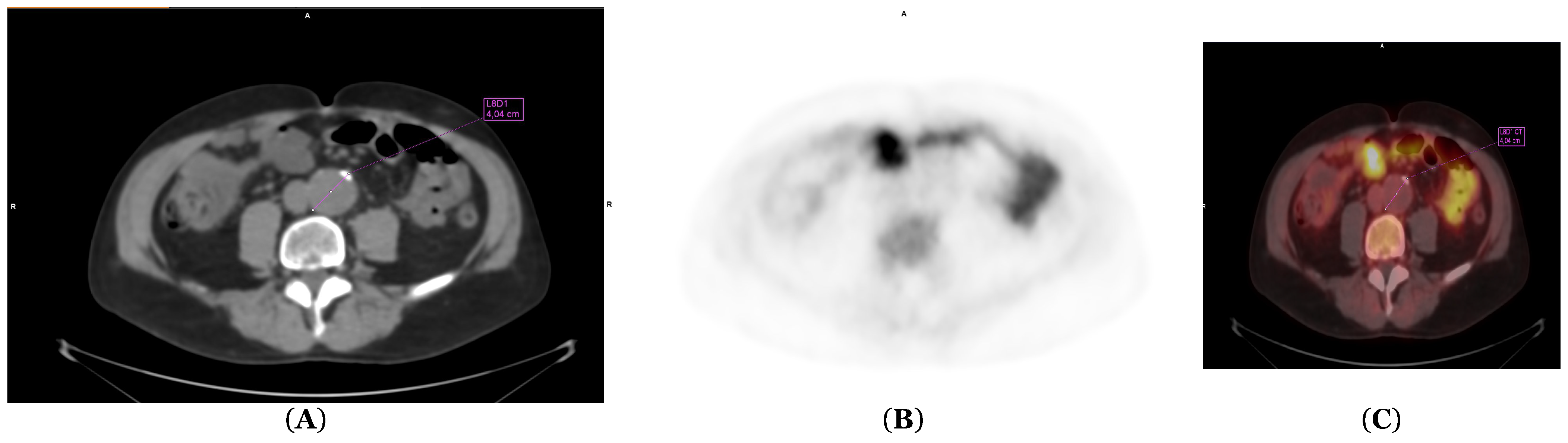 Uro 06 00017 g005