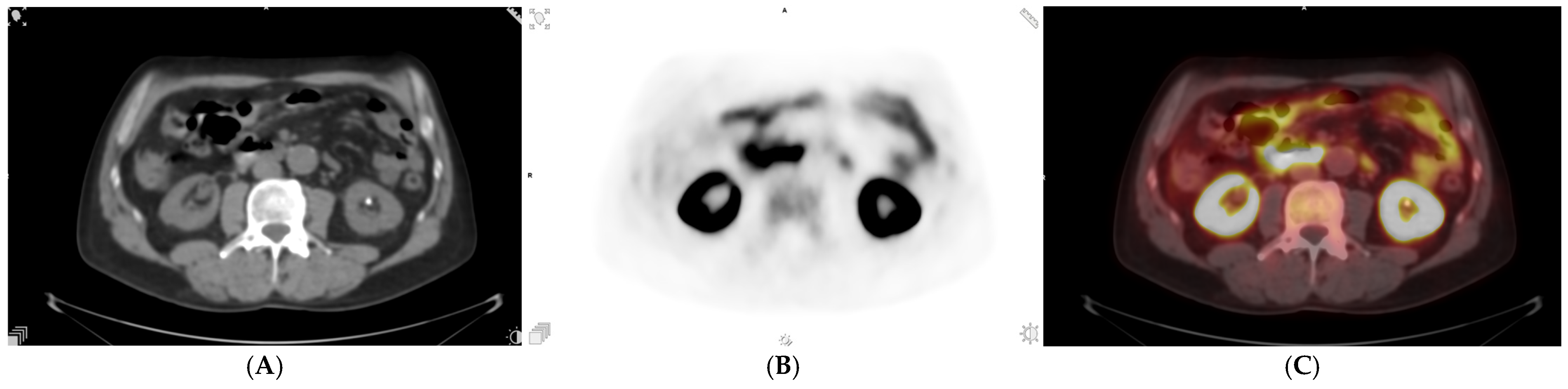 Uro 06 00017 g006