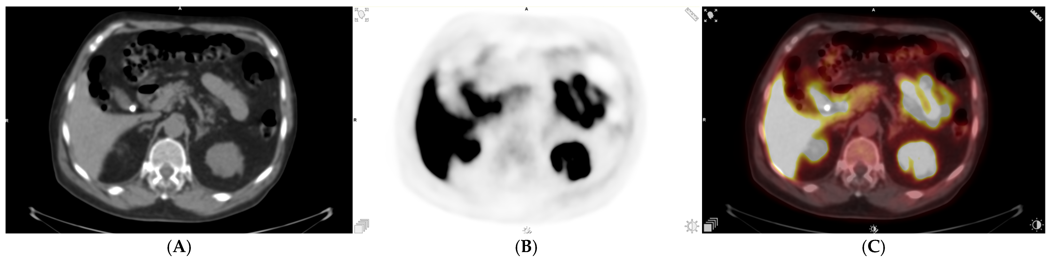 Uro 06 00017 g008